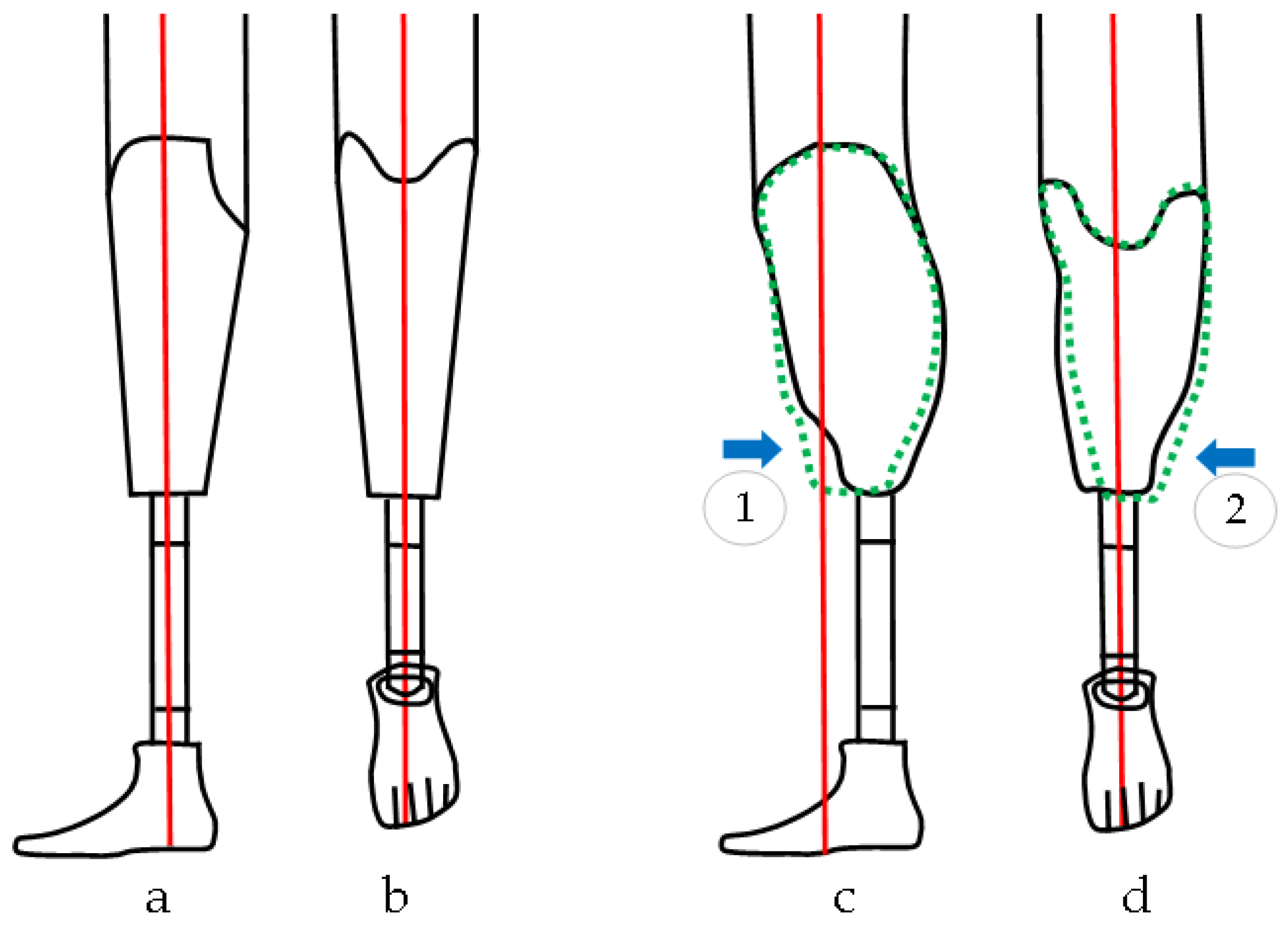 Prosthesis 07 00031 g001