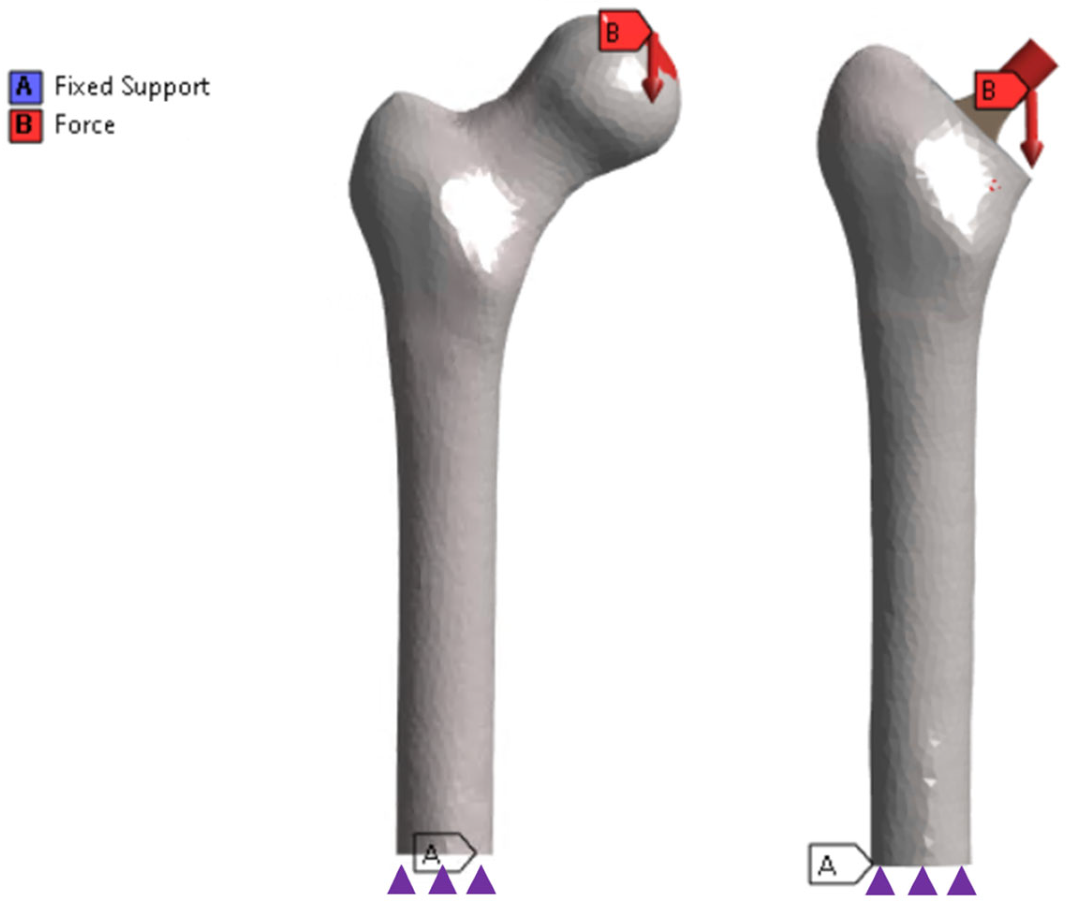 Prosthesis 07 00044 g002