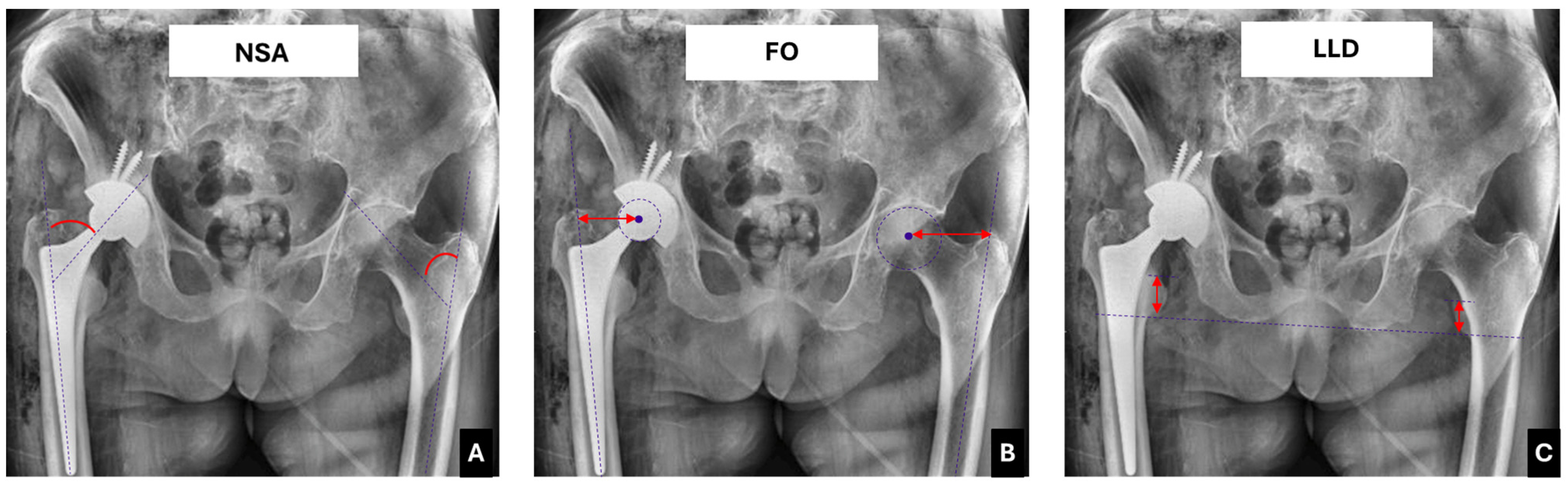 Prosthesis 07 00050 g001