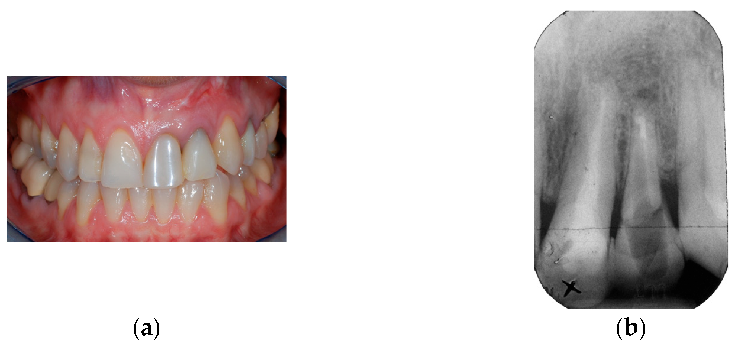 Prosthesis 07 00060 g001