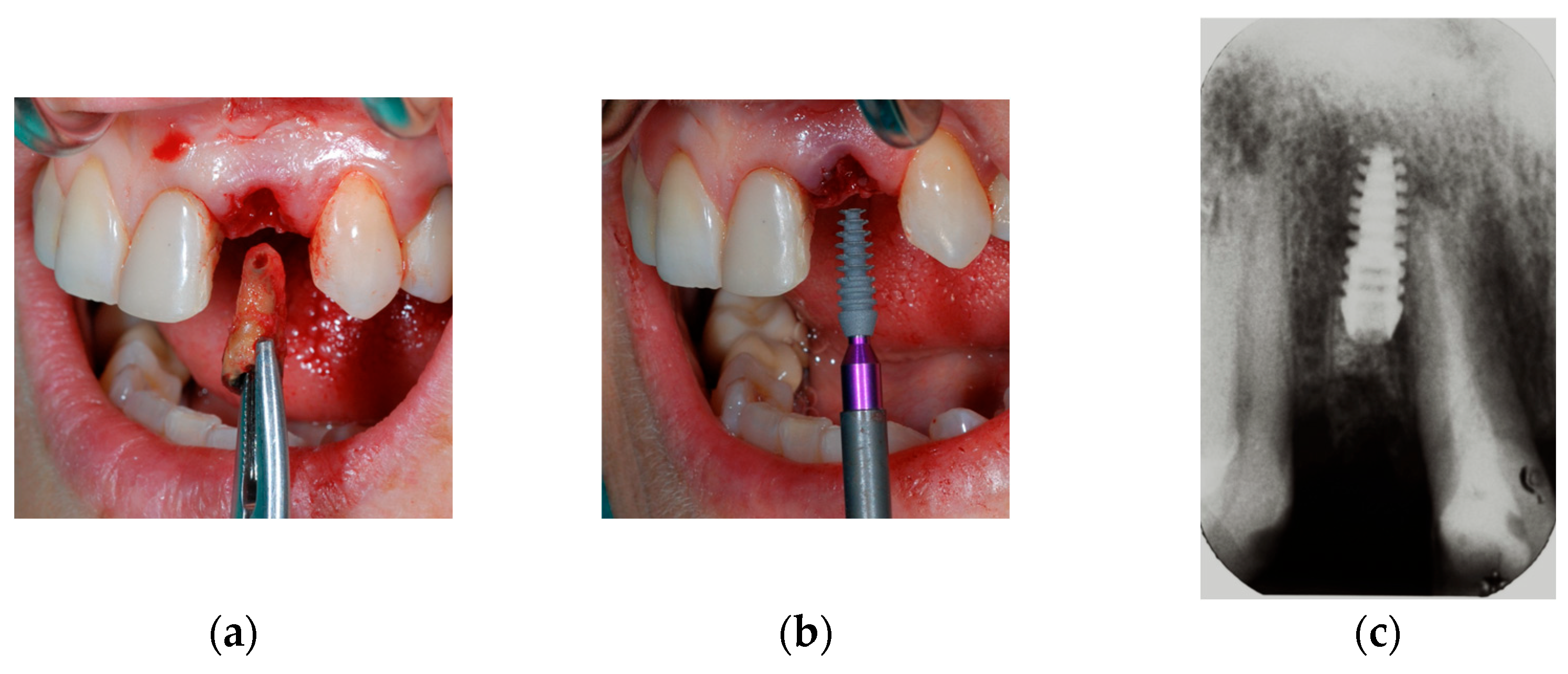 Prosthesis 07 00060 g002