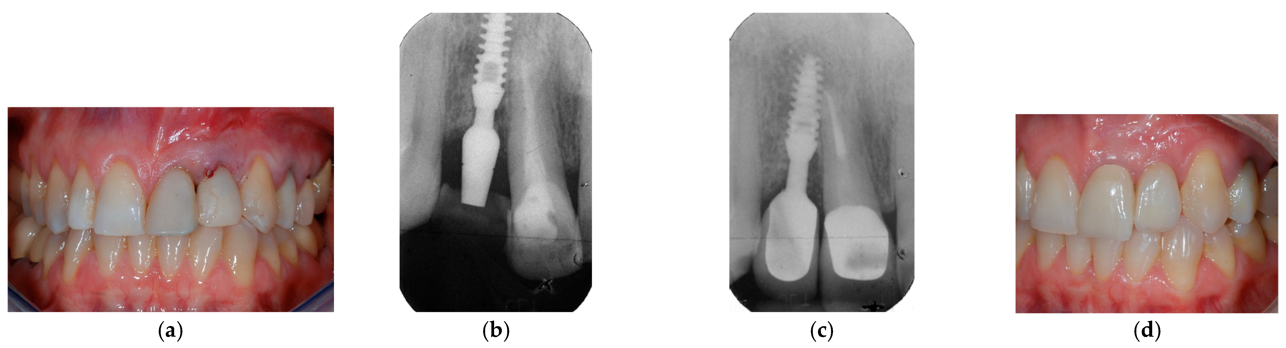 Prosthesis 07 00060 g003