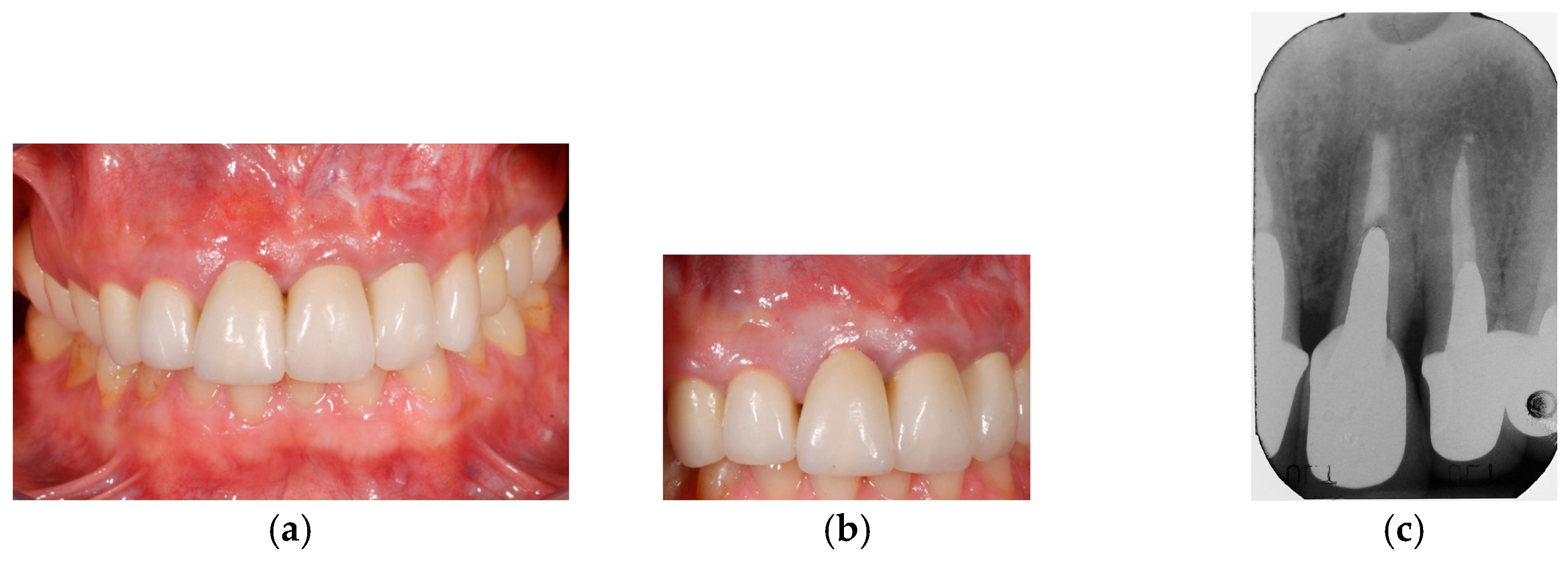 Prosthesis 07 00060 g004