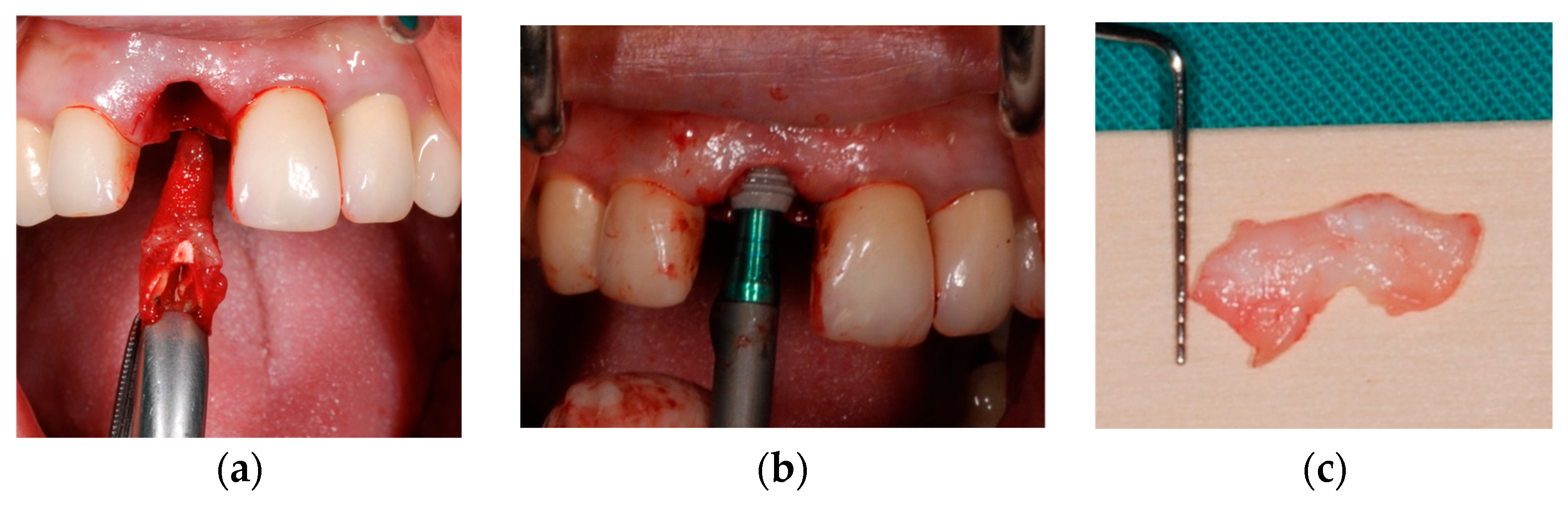 Prosthesis 07 00060 g005
