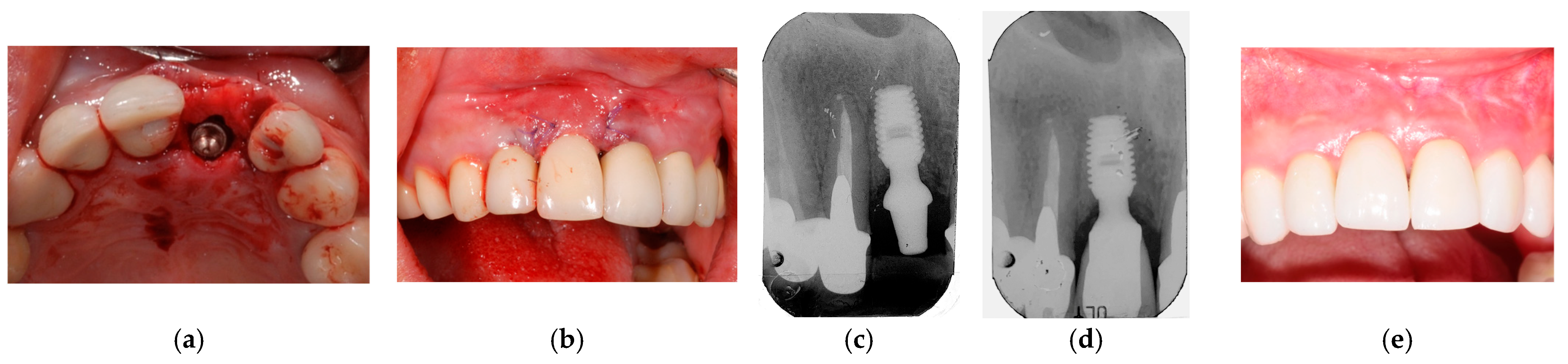 Prosthesis 07 00060 g006