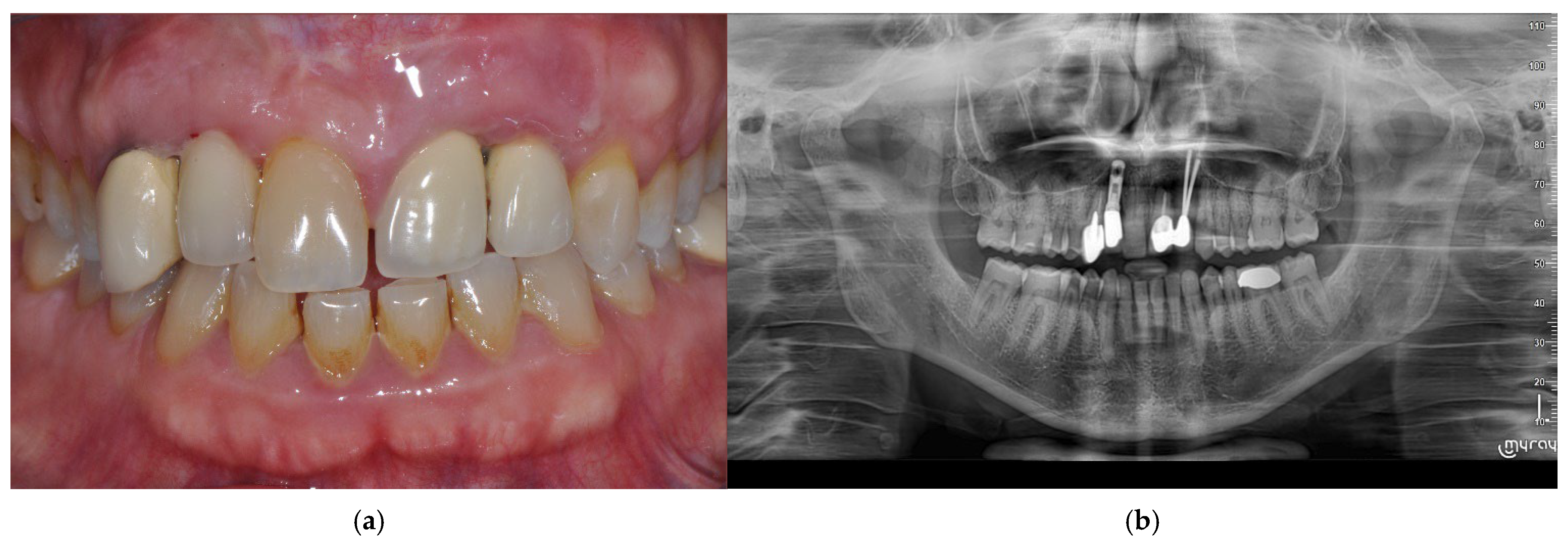 Prosthesis 07 00063 g001