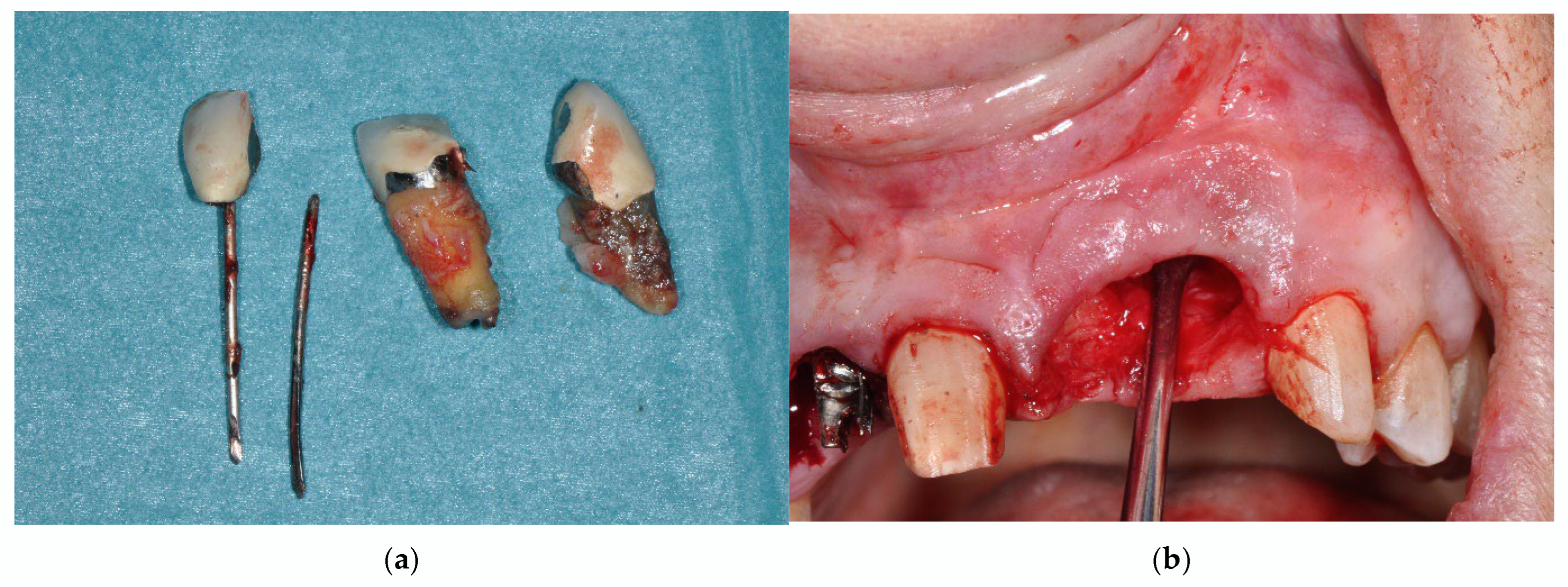 Prosthesis 07 00063 g002a