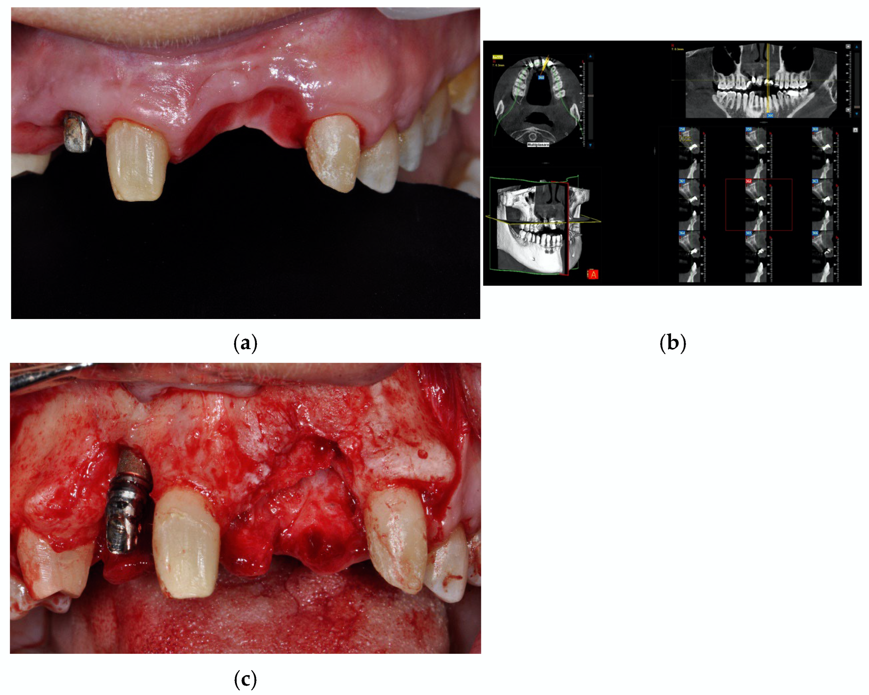 Prosthesis 07 00063 g003