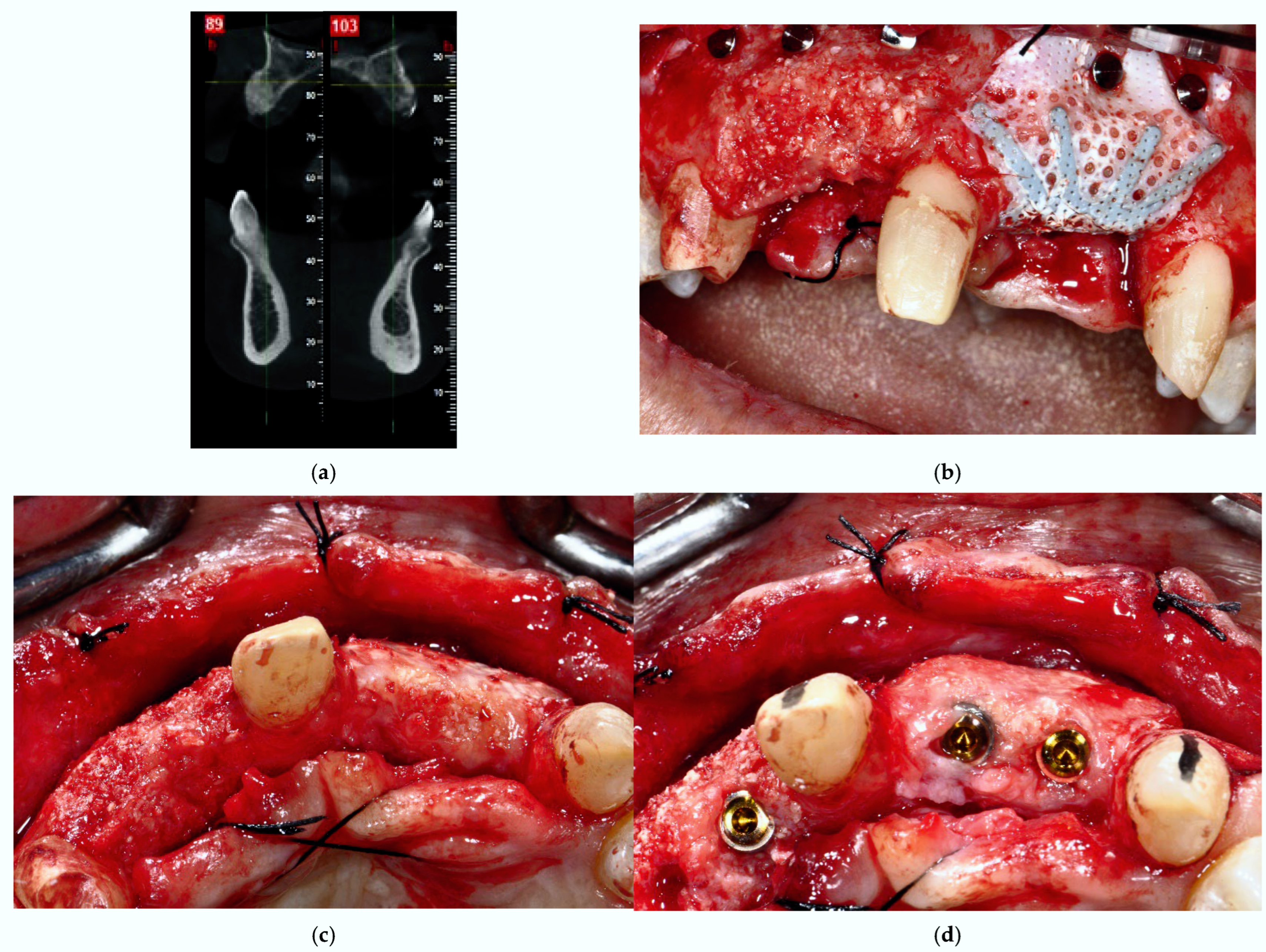 Prosthesis 07 00063 g005