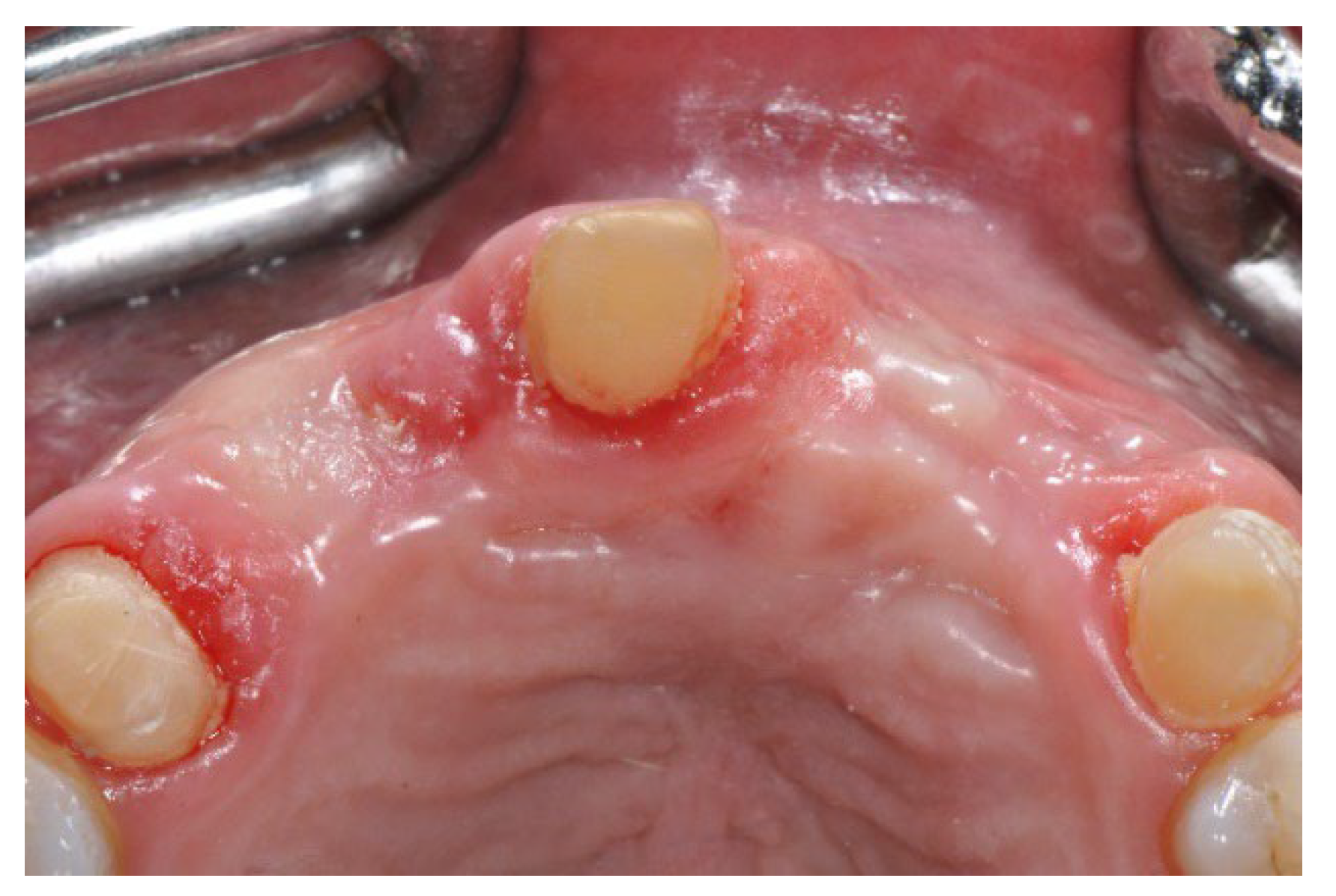 Prosthesis 07 00063 g006