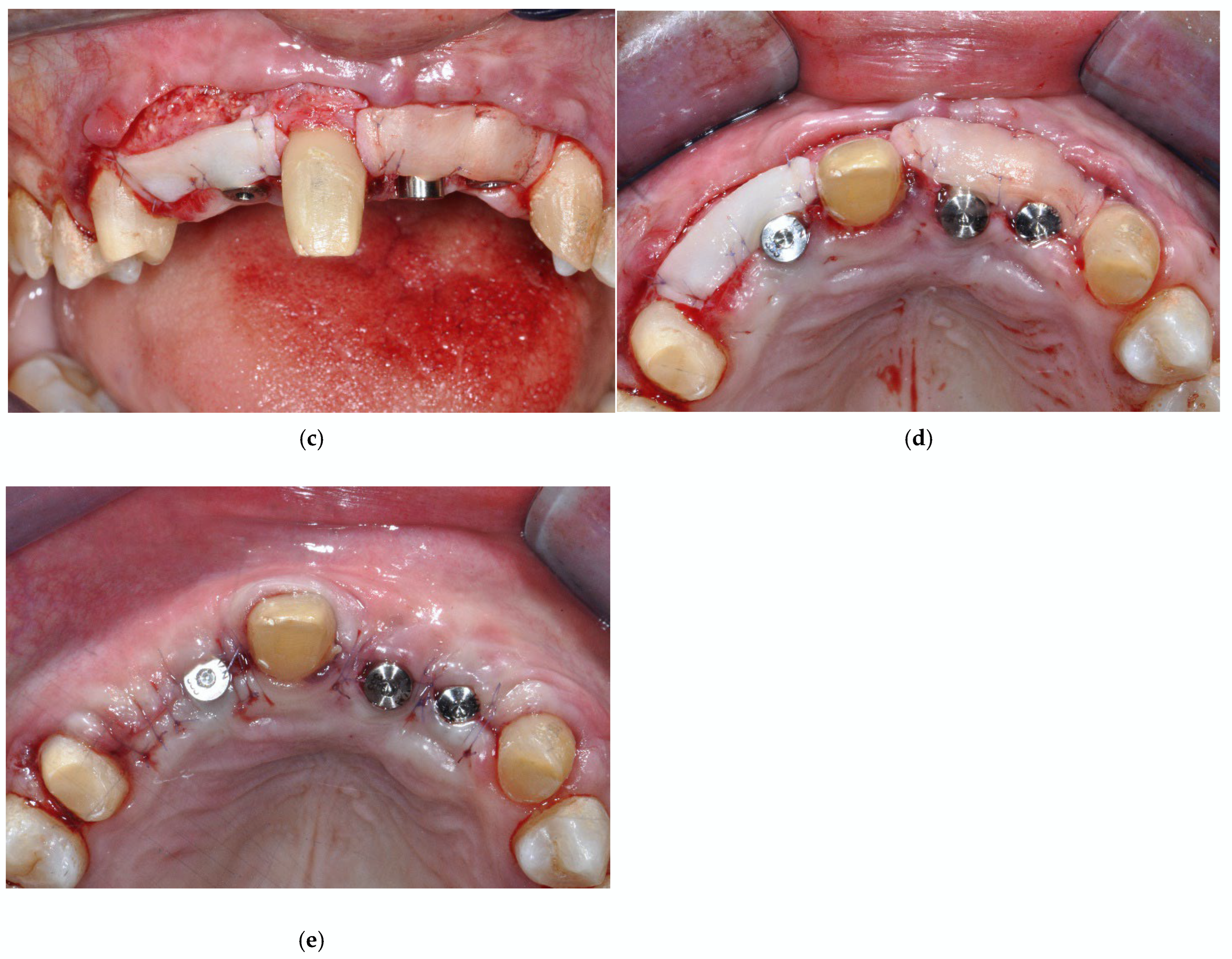 Prosthesis 07 00063 g007b