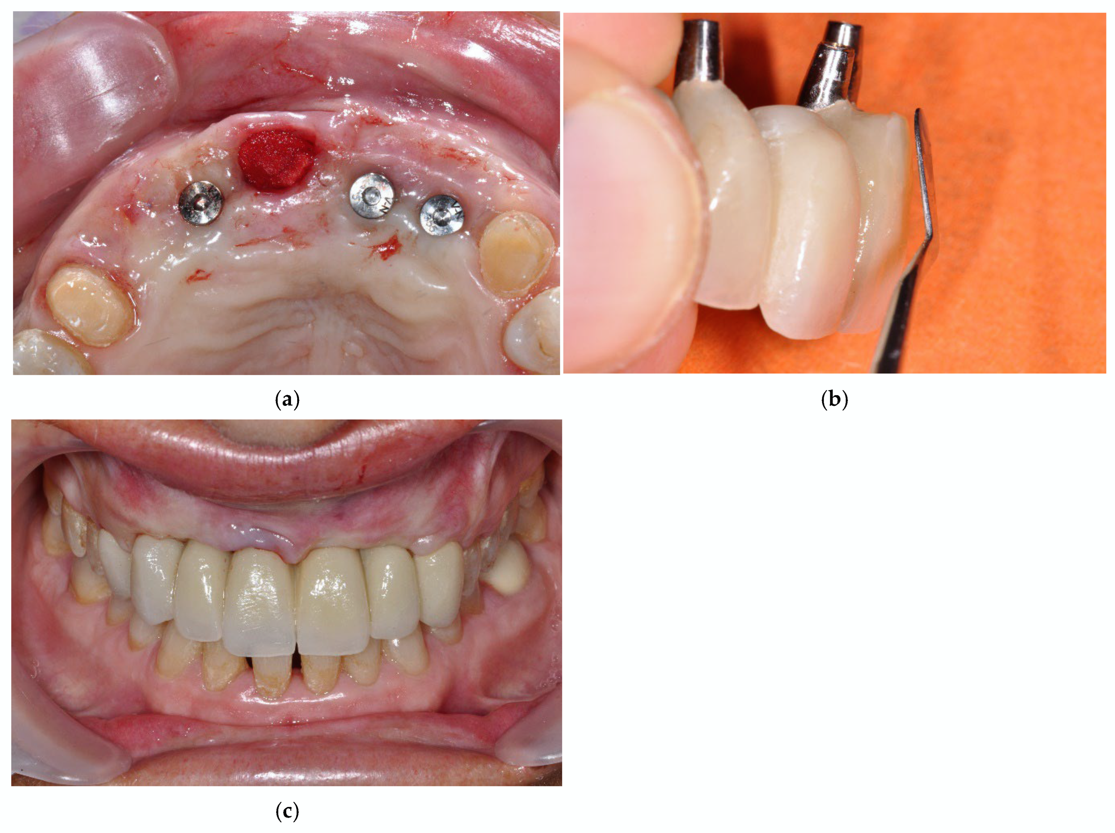 Prosthesis 07 00063 g008