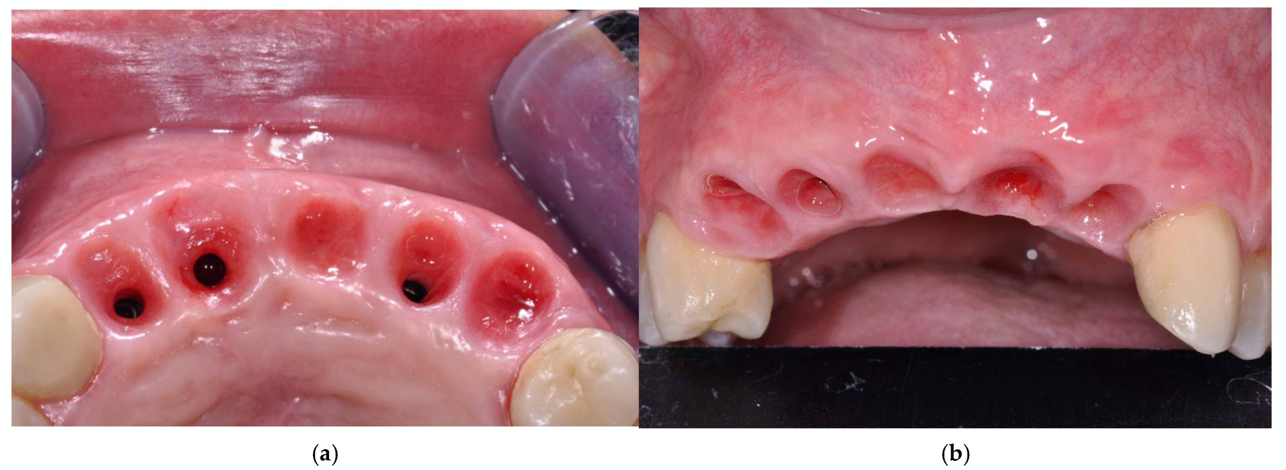 Prosthesis 07 00063 g009