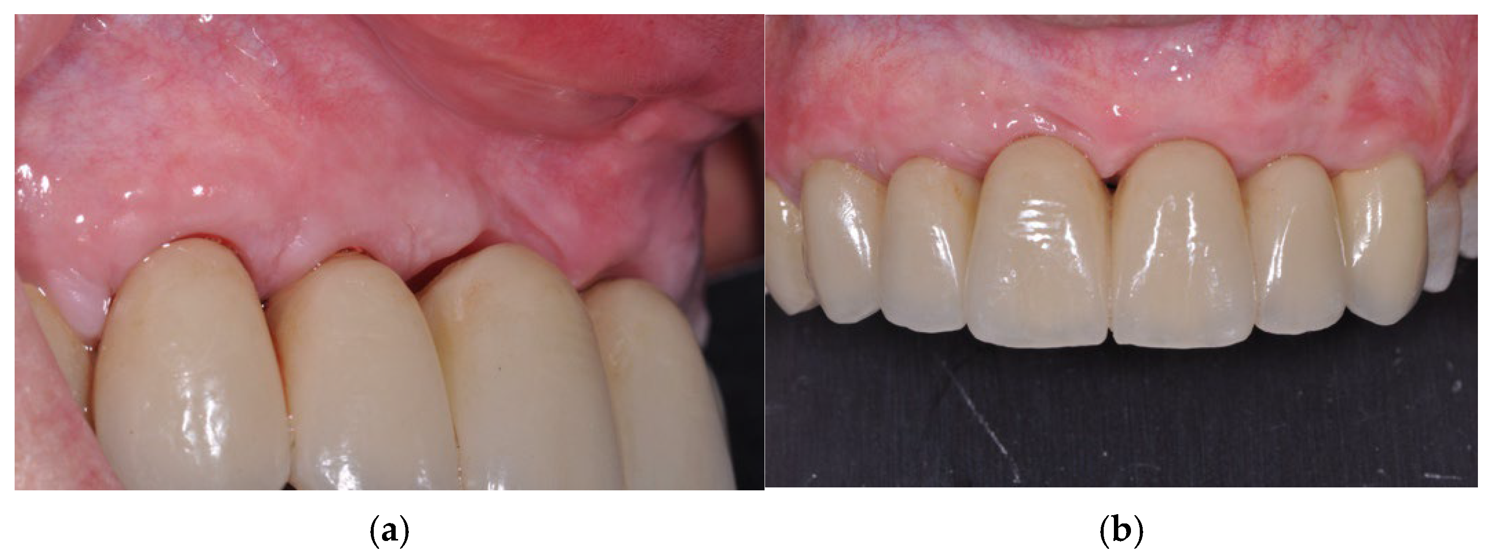 Prosthesis 07 00063 g010