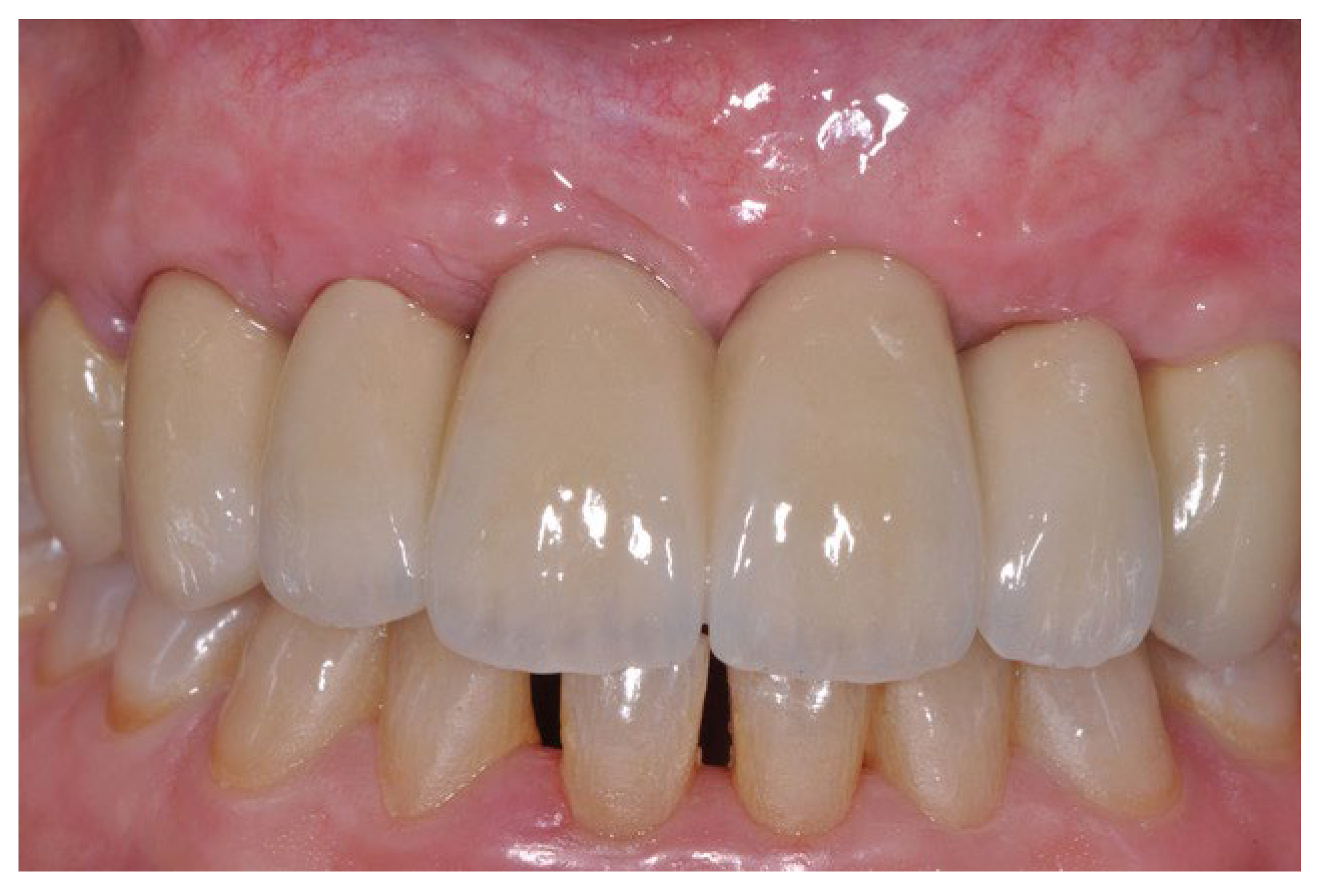 Prosthesis 07 00063 g011