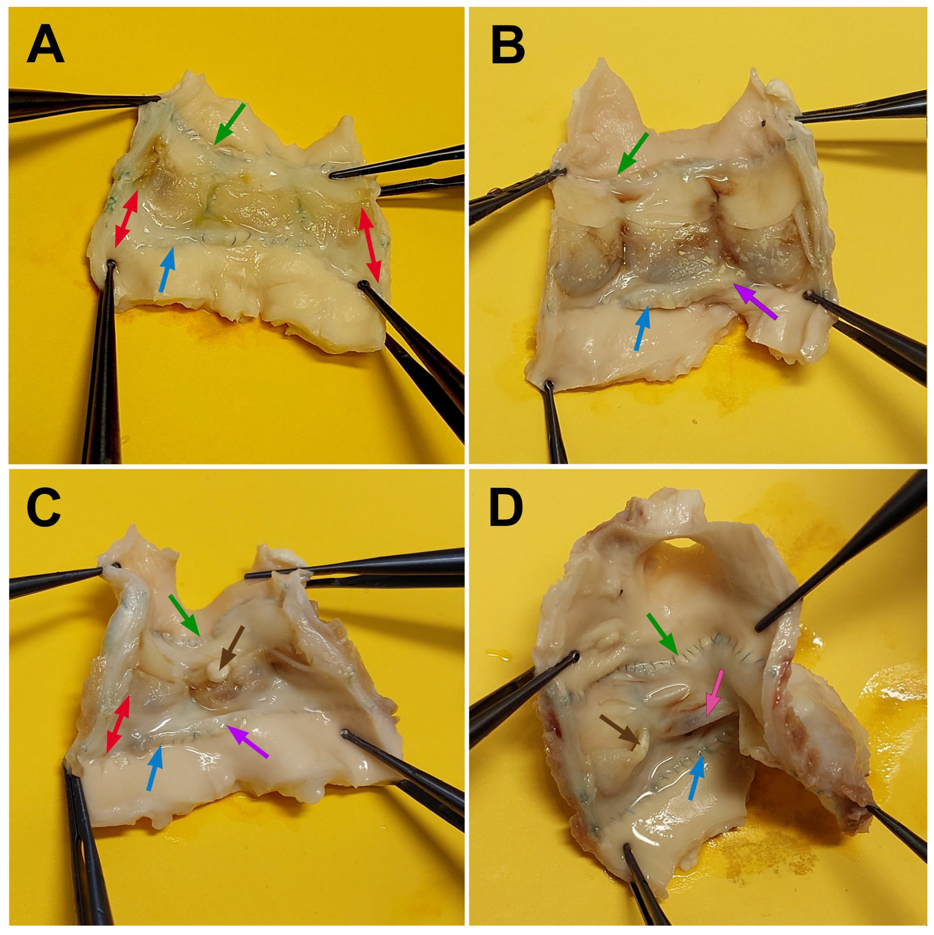Prosthesis 07 00067 g006