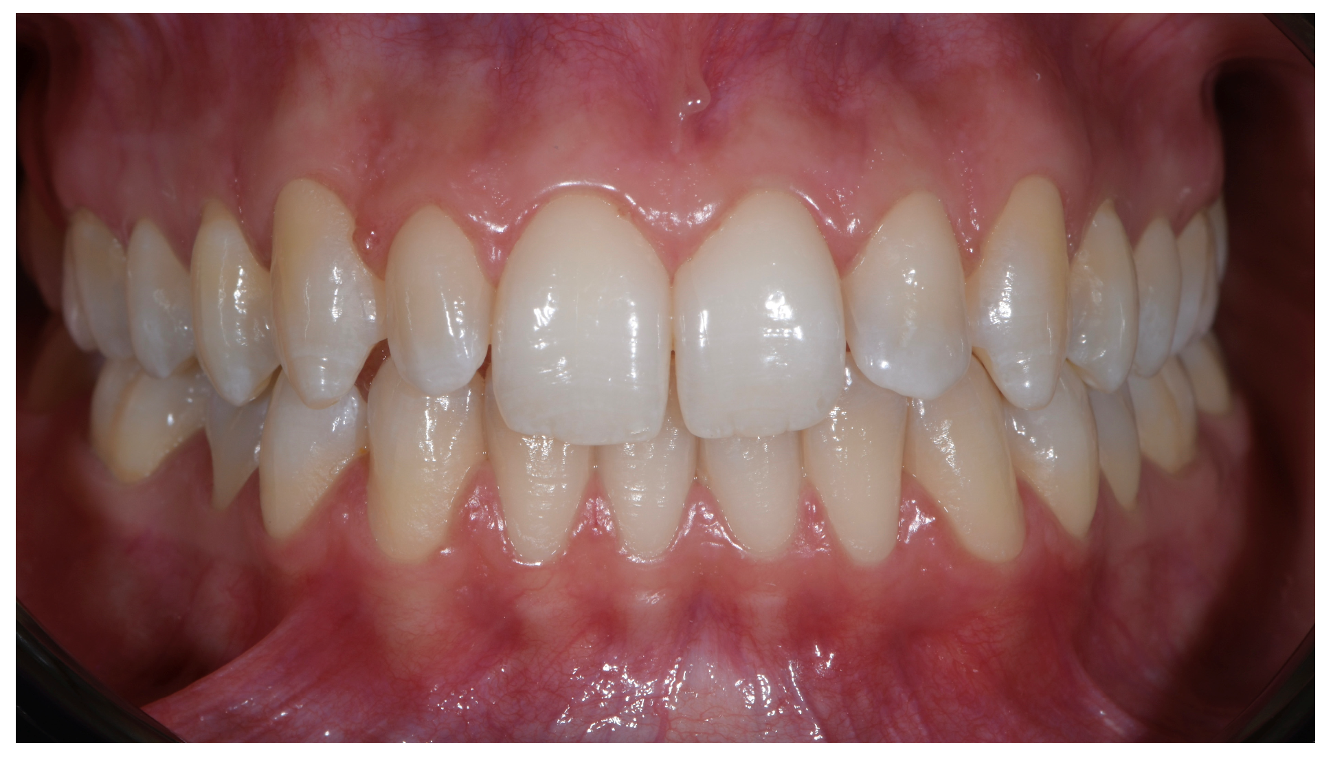 Prosthesis 07 00068 g001