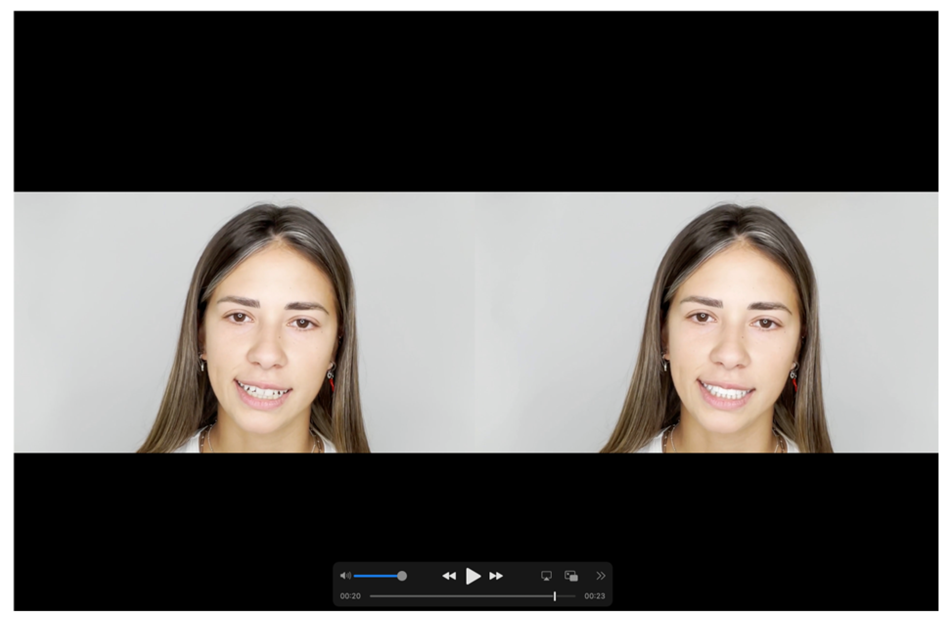 Prosthesis 07 00068 g006