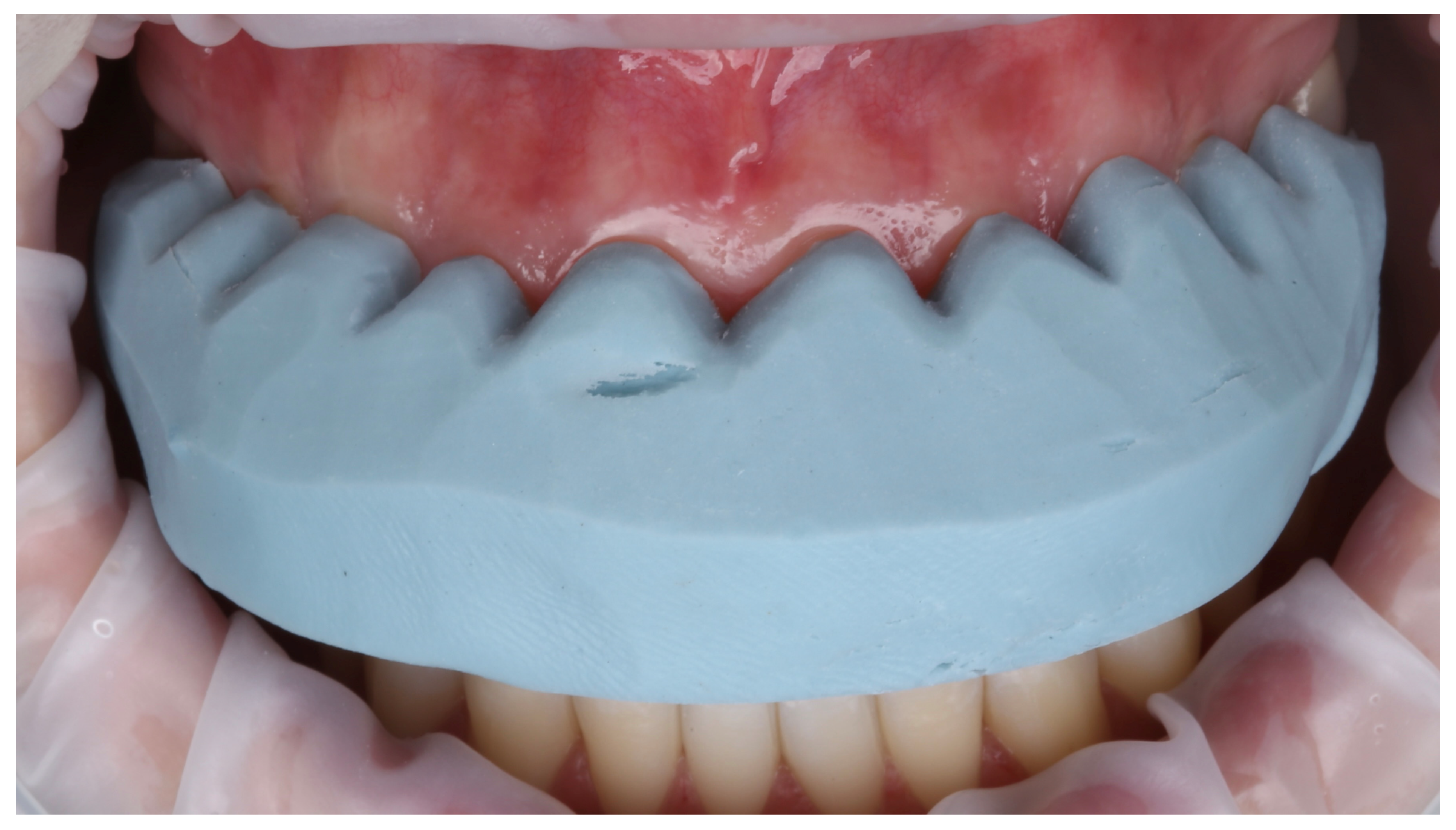 Prosthesis 07 00068 g008