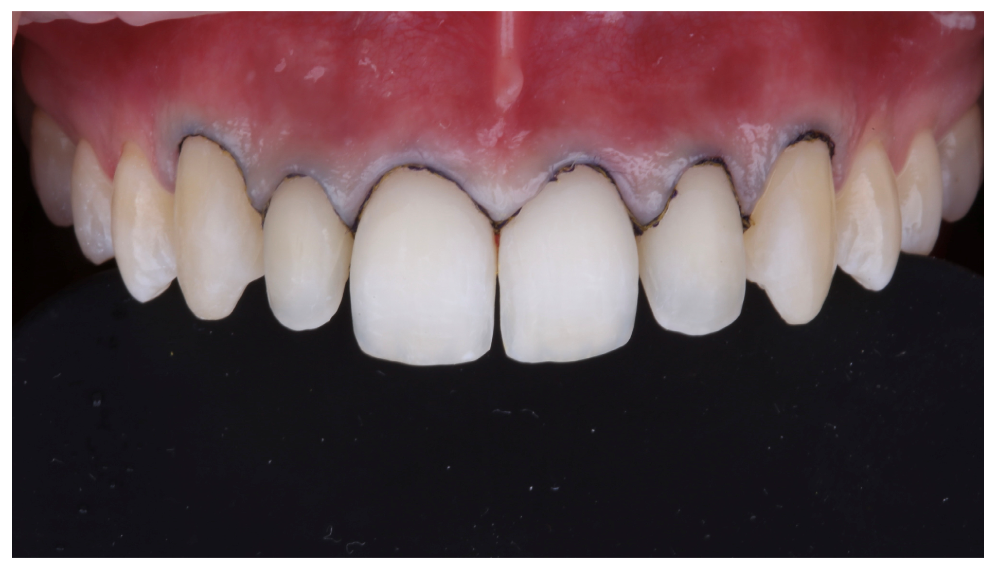 Prosthesis 07 00068 g010