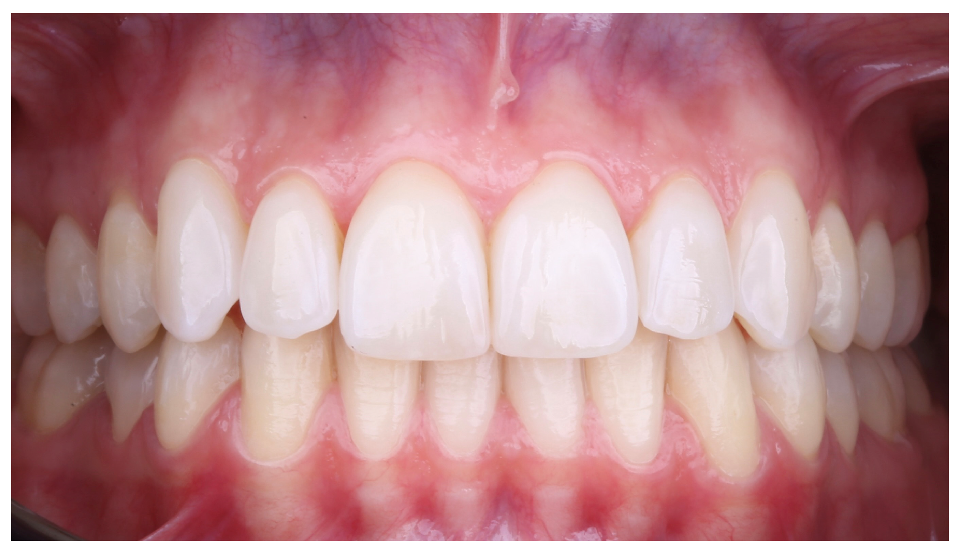 Prosthesis 07 00068 g011