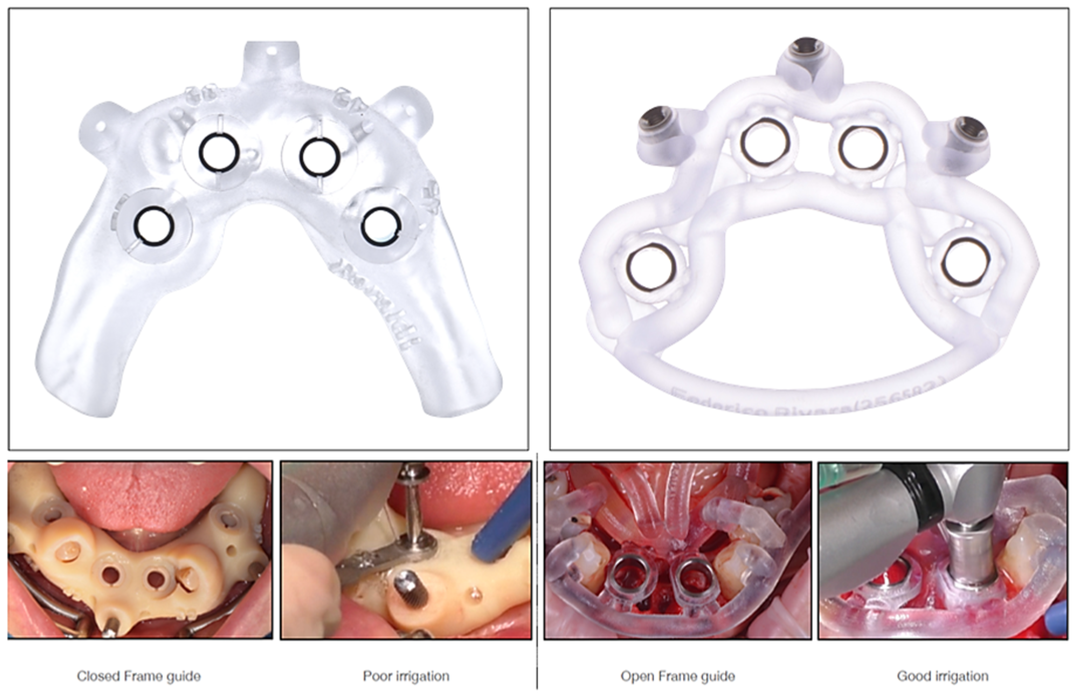 Prosthesis 07 00076 g001