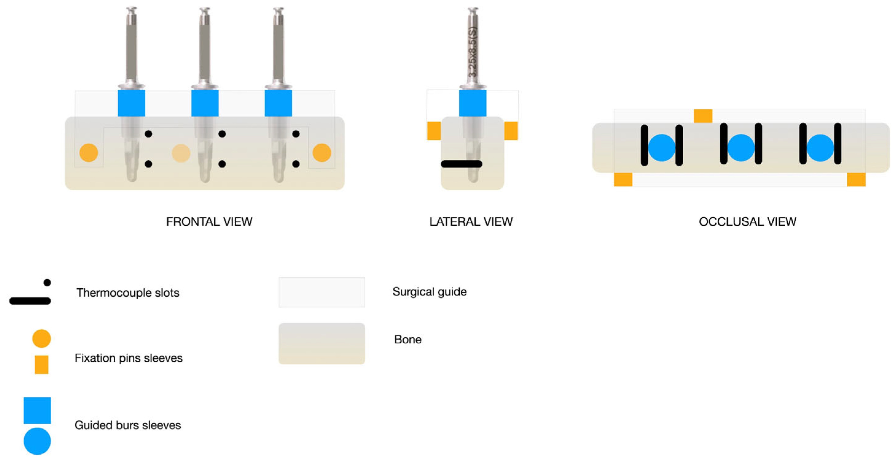 Prosthesis 07 00076 g003