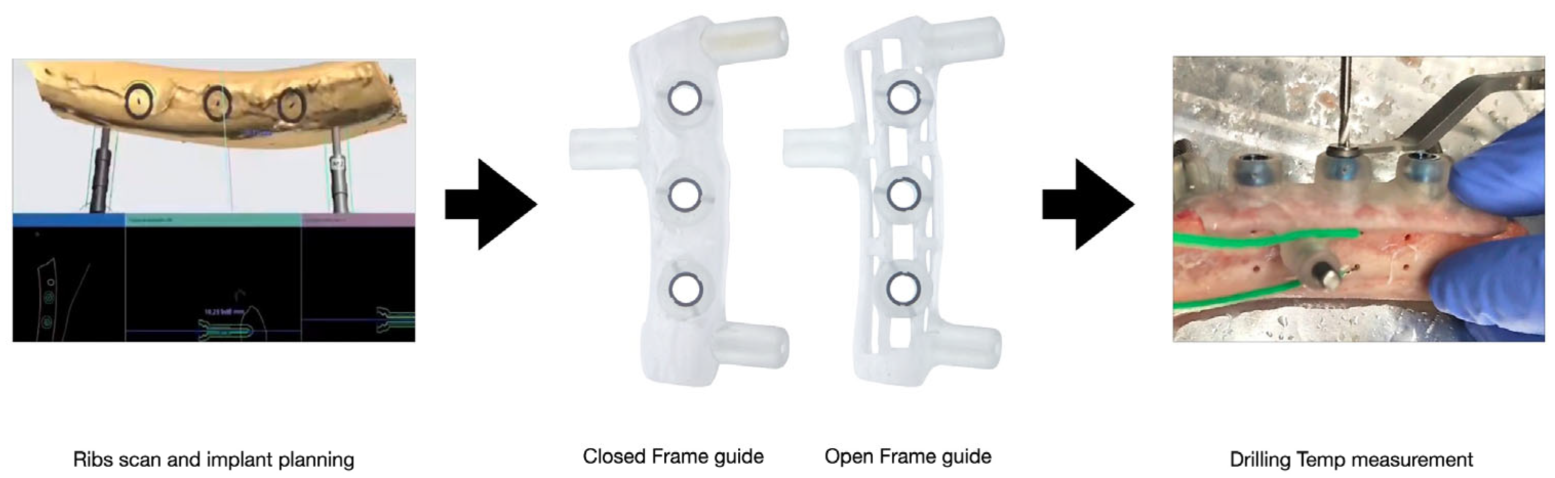 Prosthesis 07 00076 g004