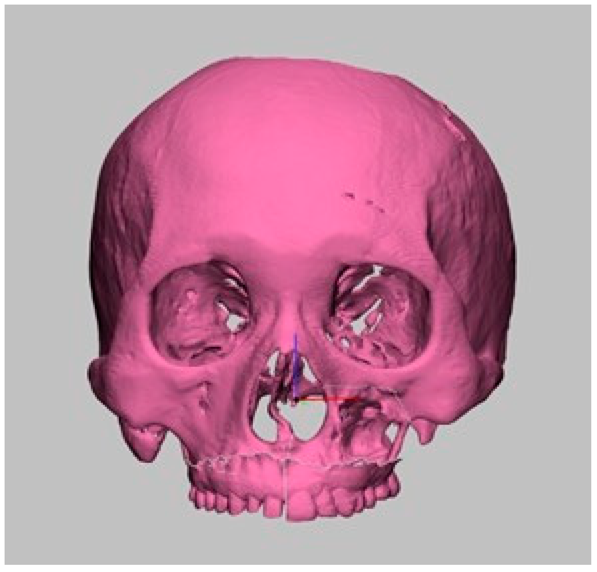 Prosthesis 07 00080 g003
