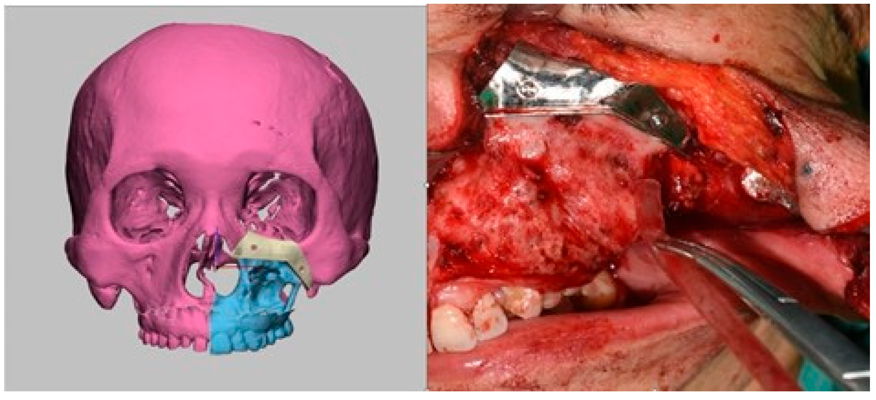 Prosthesis 07 00080 g004