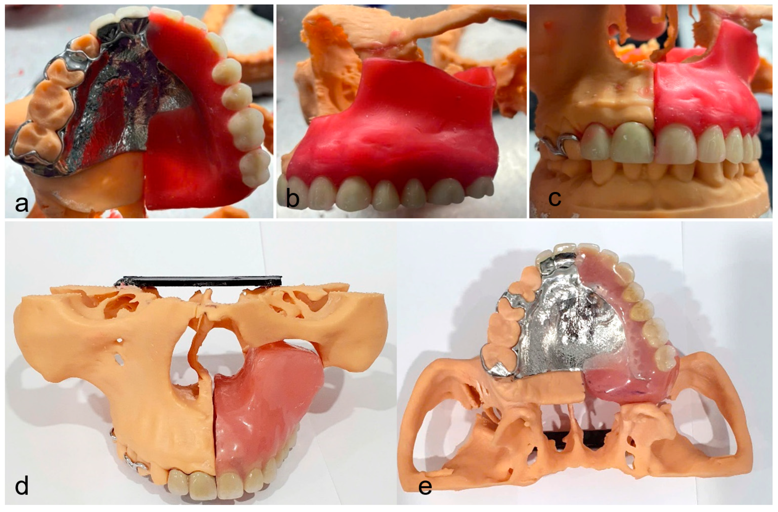 Prosthesis 07 00080 g006