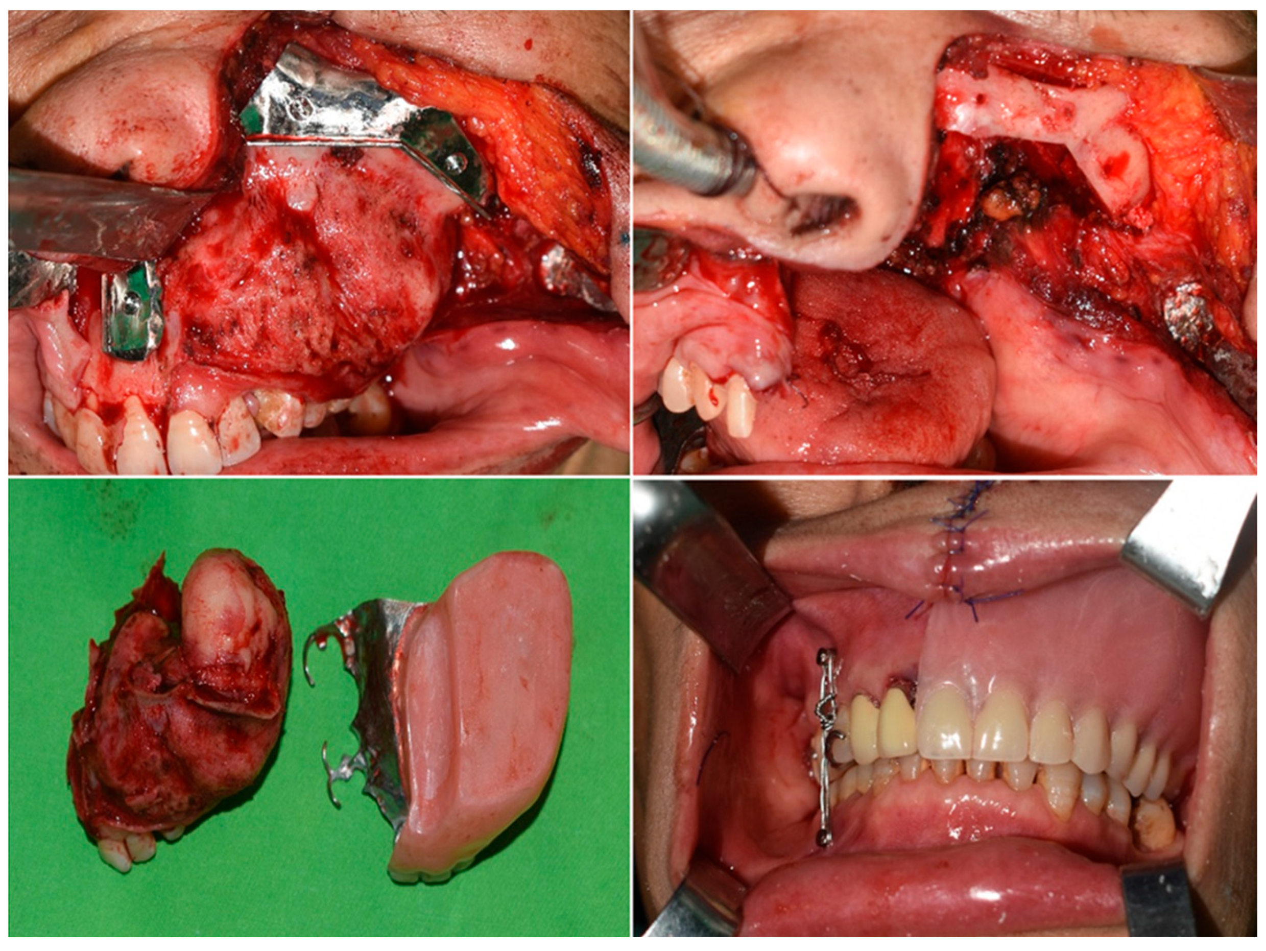 Prosthesis 07 00080 g007