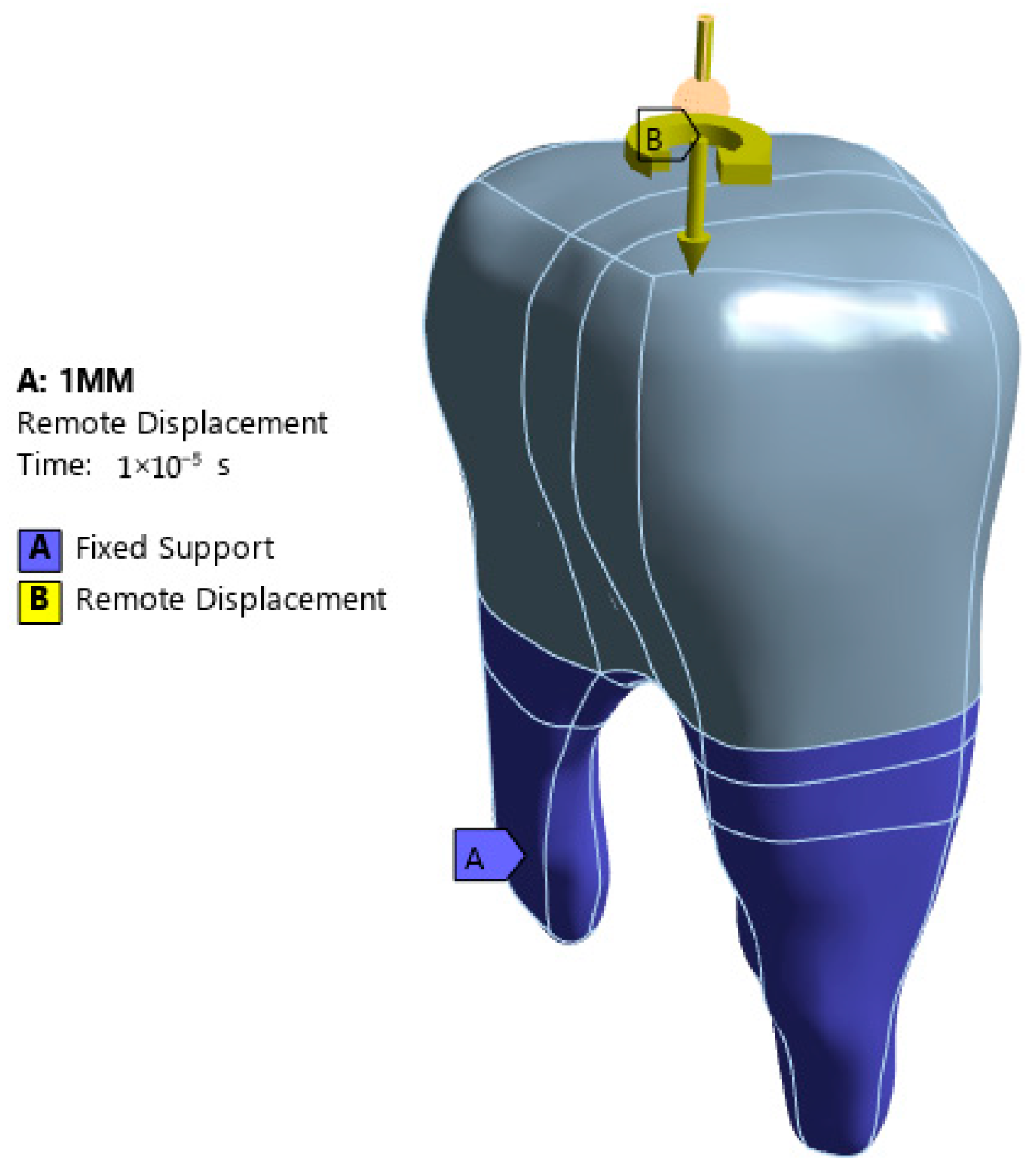 Prosthesis 07 00084 g006