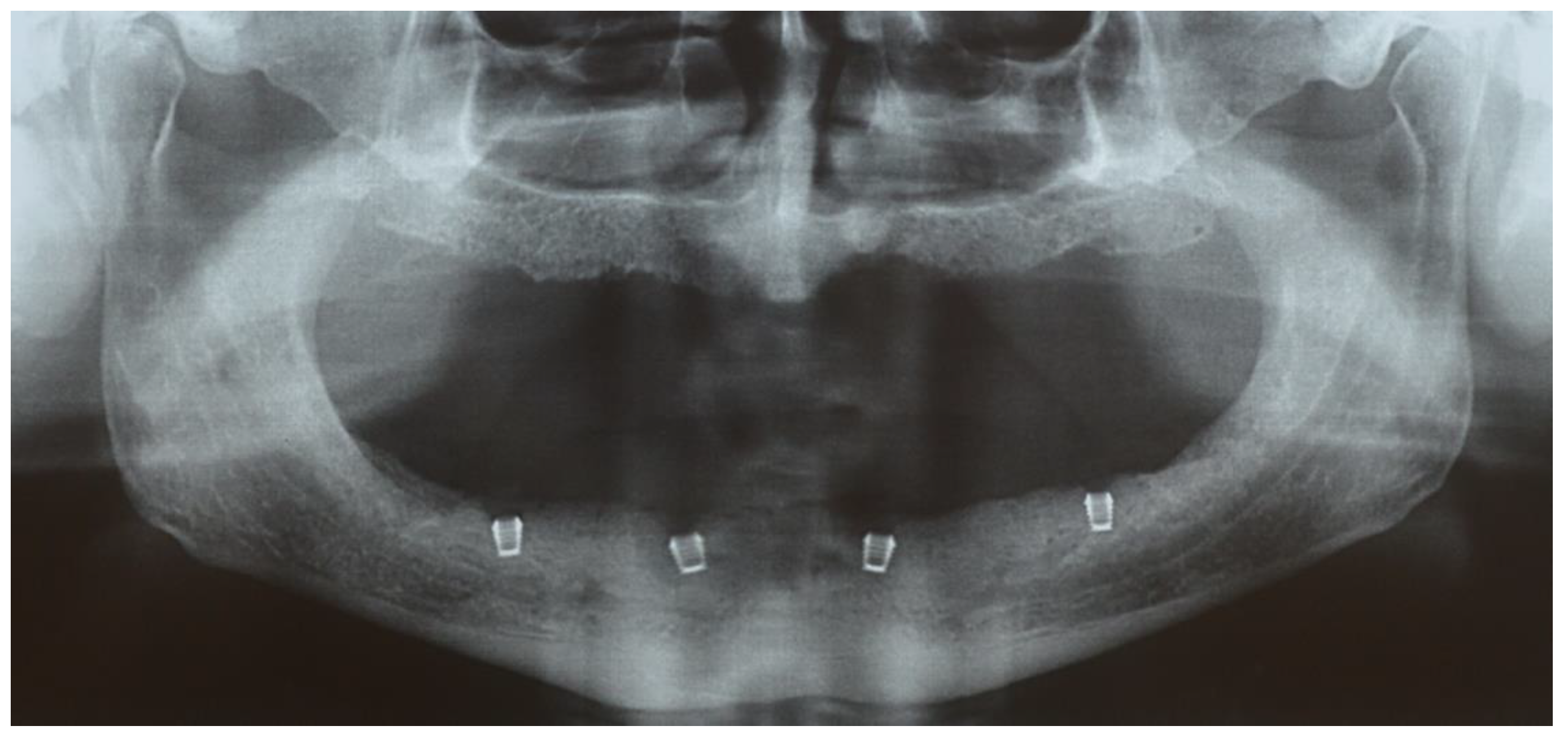 Prosthesis 07 00094 g001