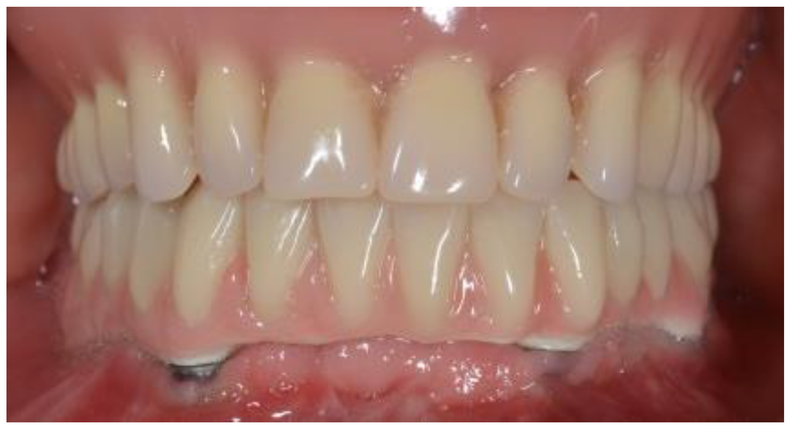 Prosthesis 07 00094 g003