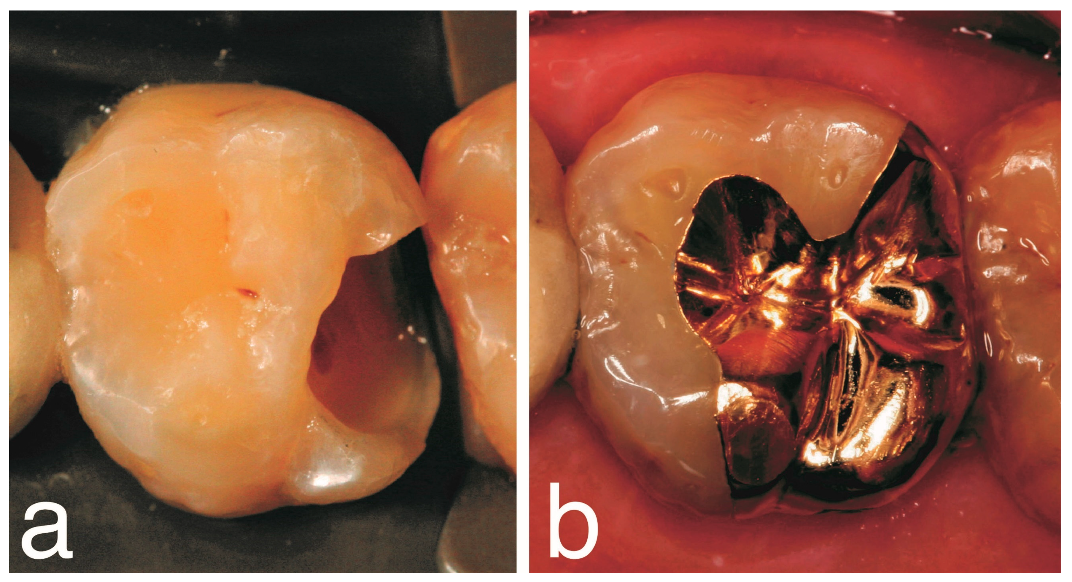 Prosthesis 07 00103 g004