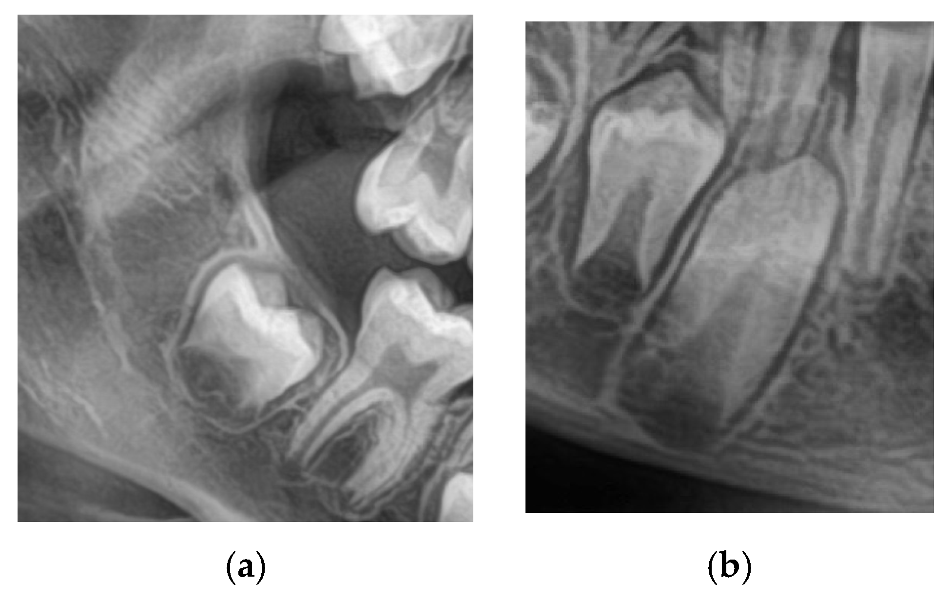 Prosthesis 07 00116 g002
