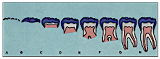 Prosthesis 07 00116 i001