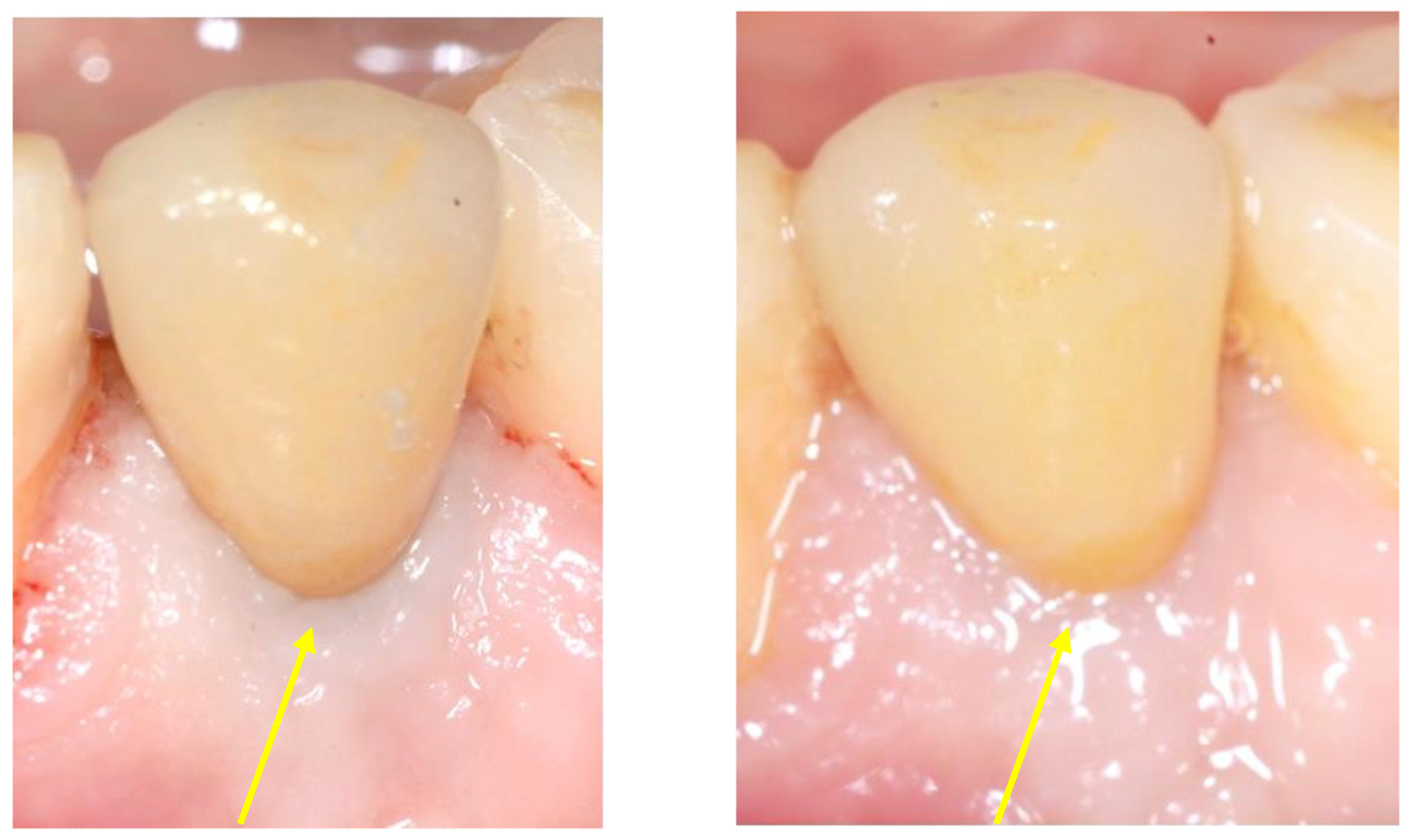 Prosthesis 07 00117 g007 Prosthesis 07 00117 g007