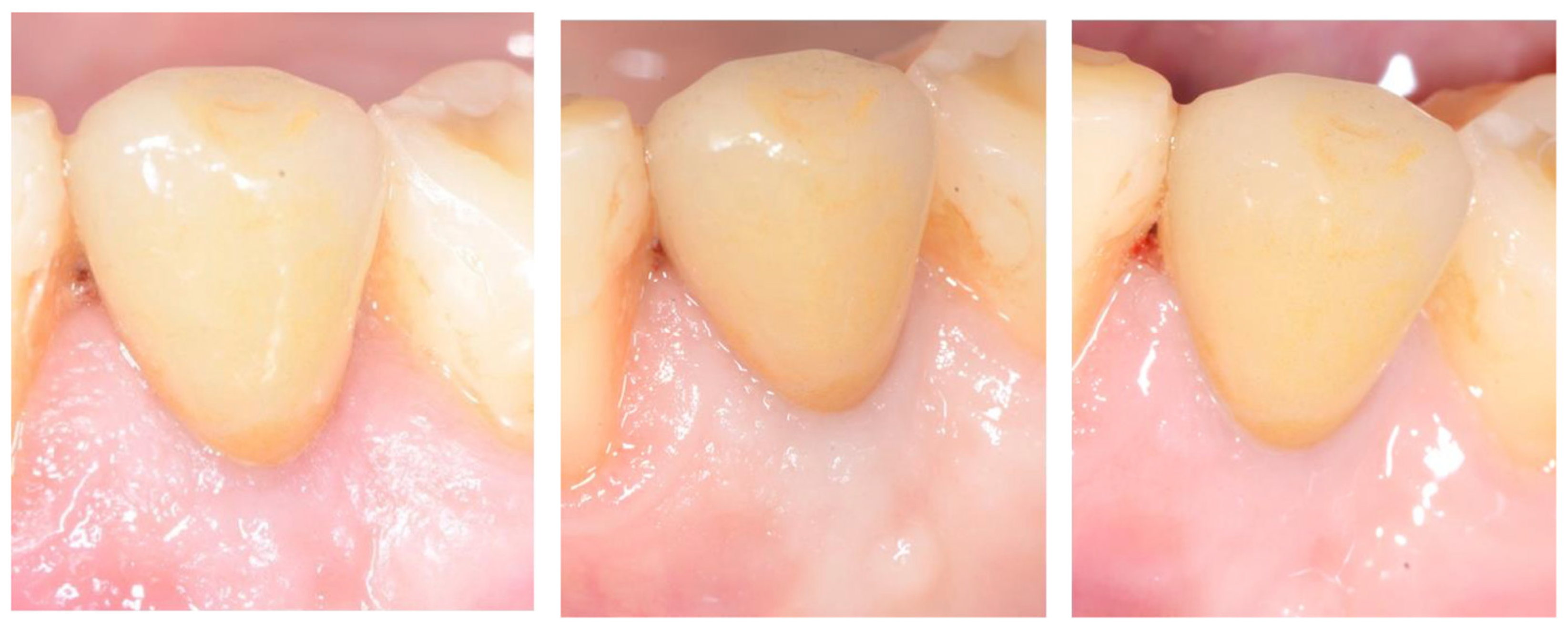 Prosthesis 07 00117 g008 Prosthesis 07 00117 g008