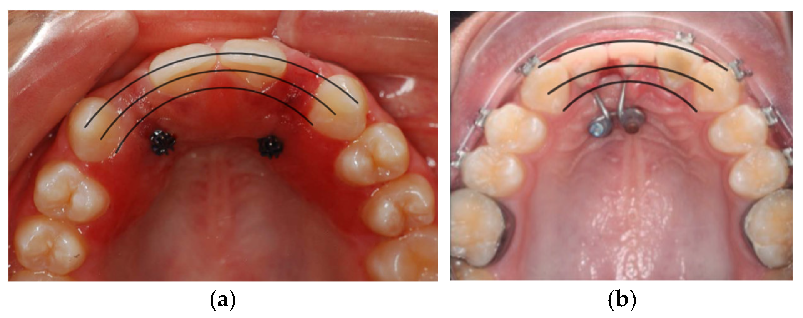 Prosthesis 07 00120 g001