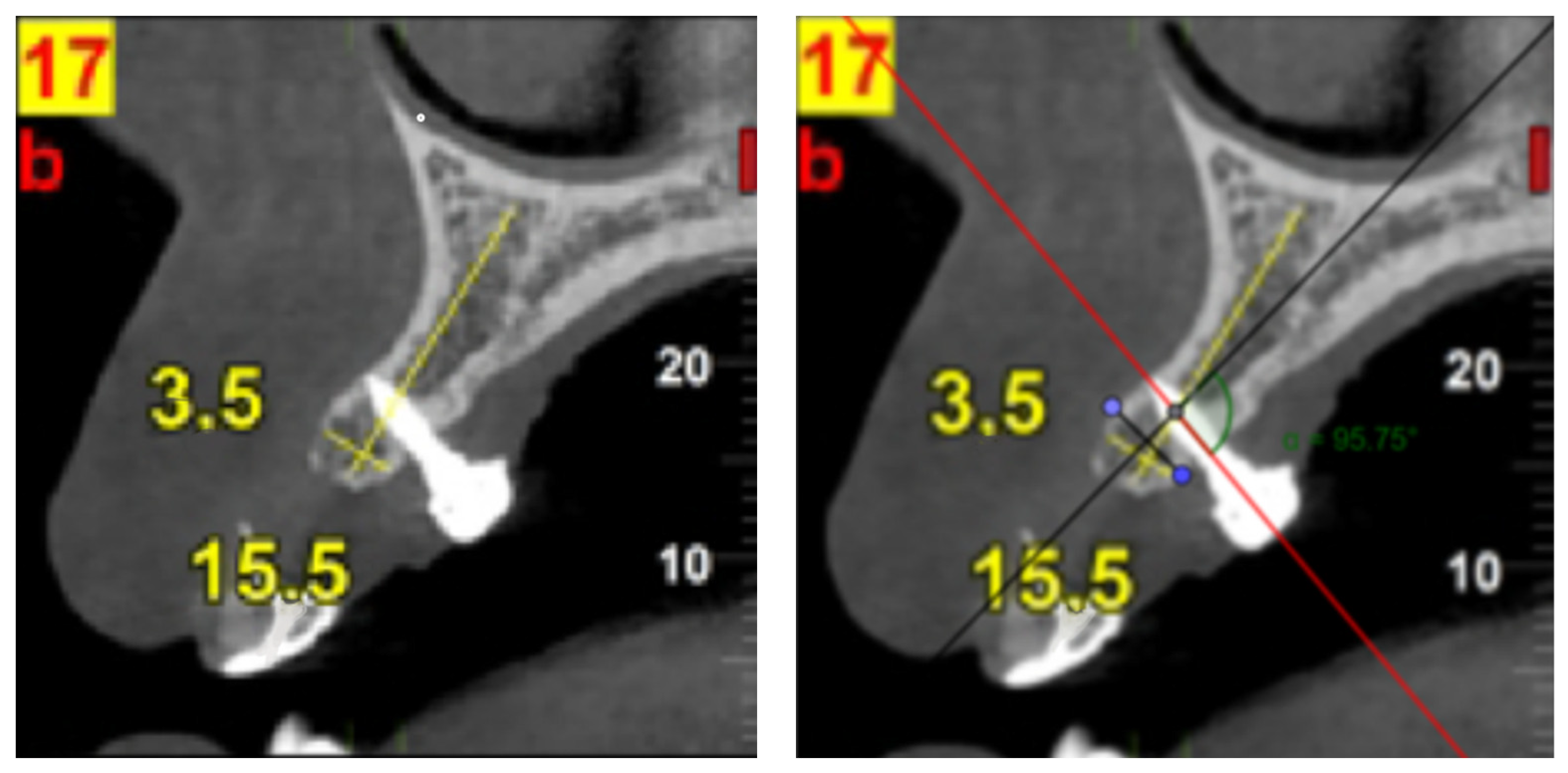 Prosthesis 07 00120 g002