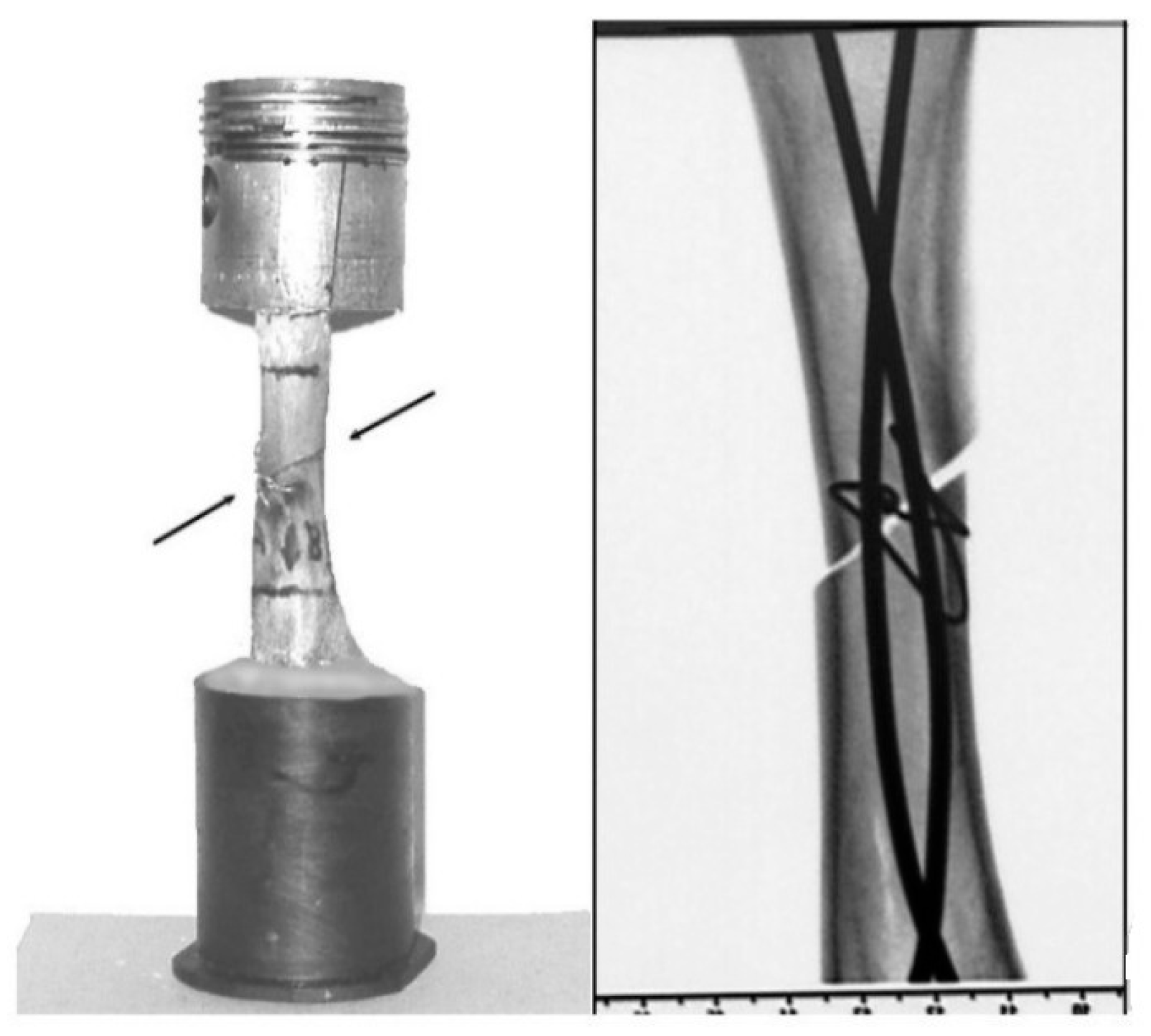 Prosthesis 07 00126 g014
