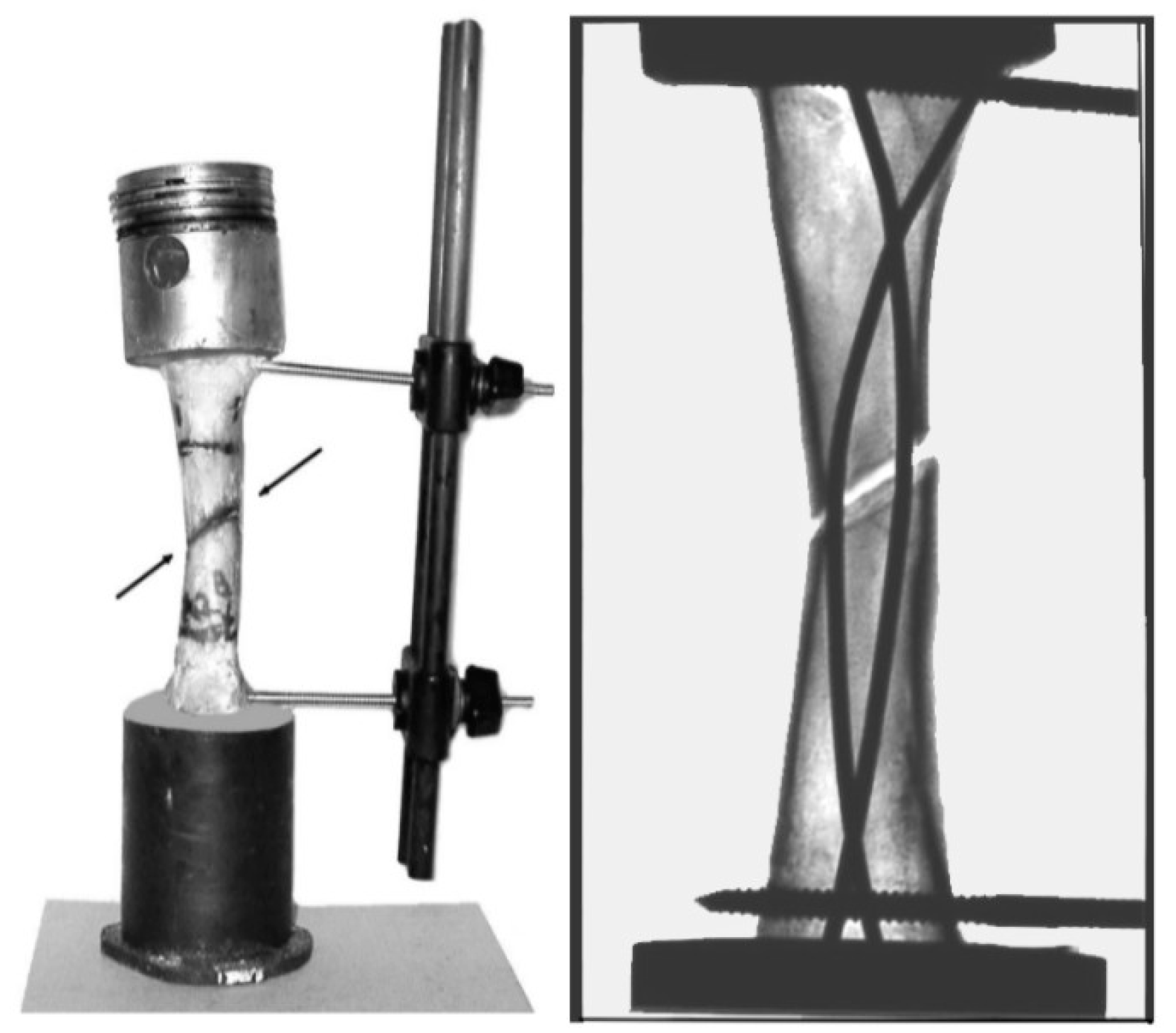 Prosthesis 07 00126 g015