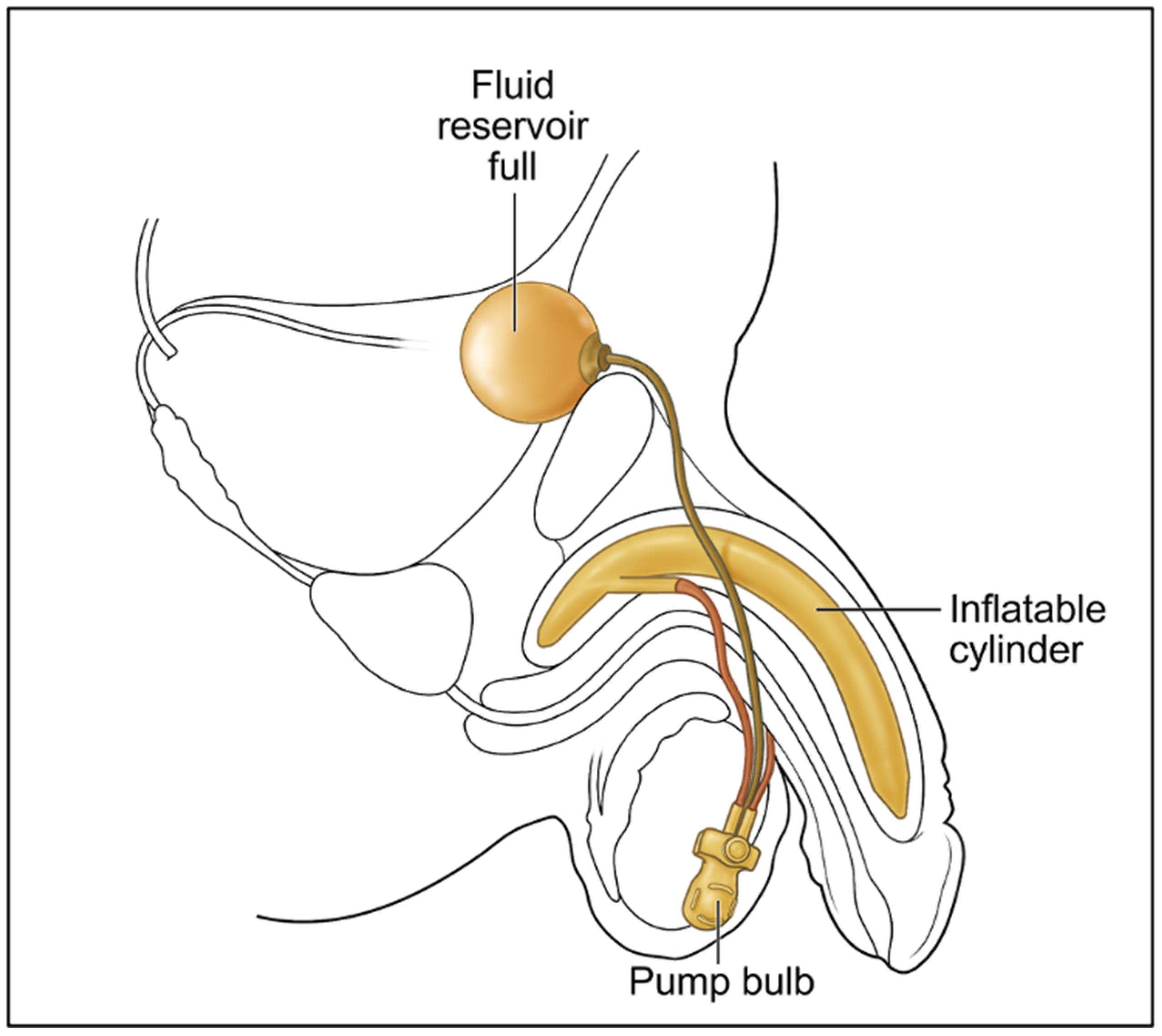 Prosthesis 07 00127 g001 Prosthesis 07 00127 g001