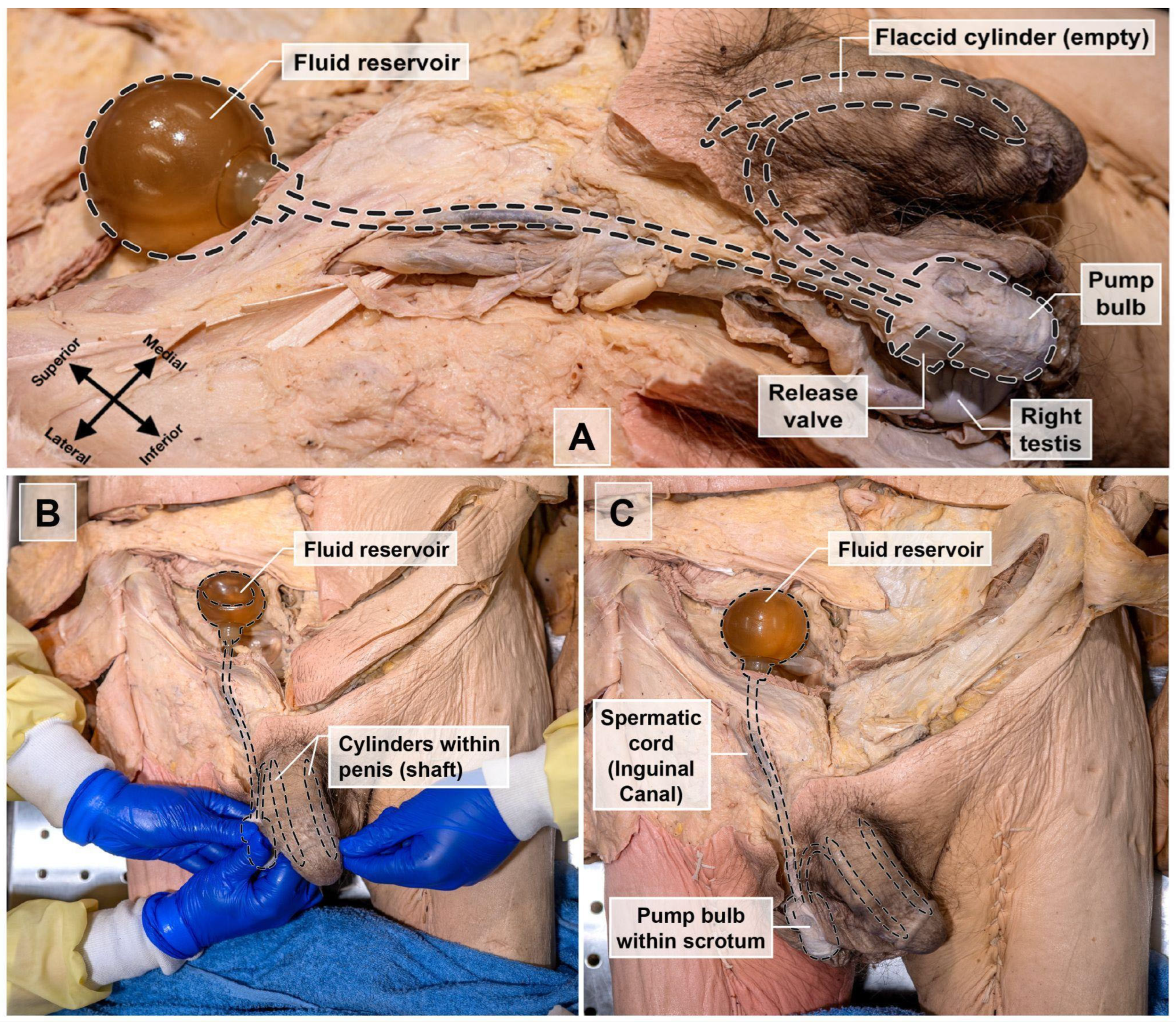 Prosthesis 07 00127 g002 Prosthesis 07 00127 g002
