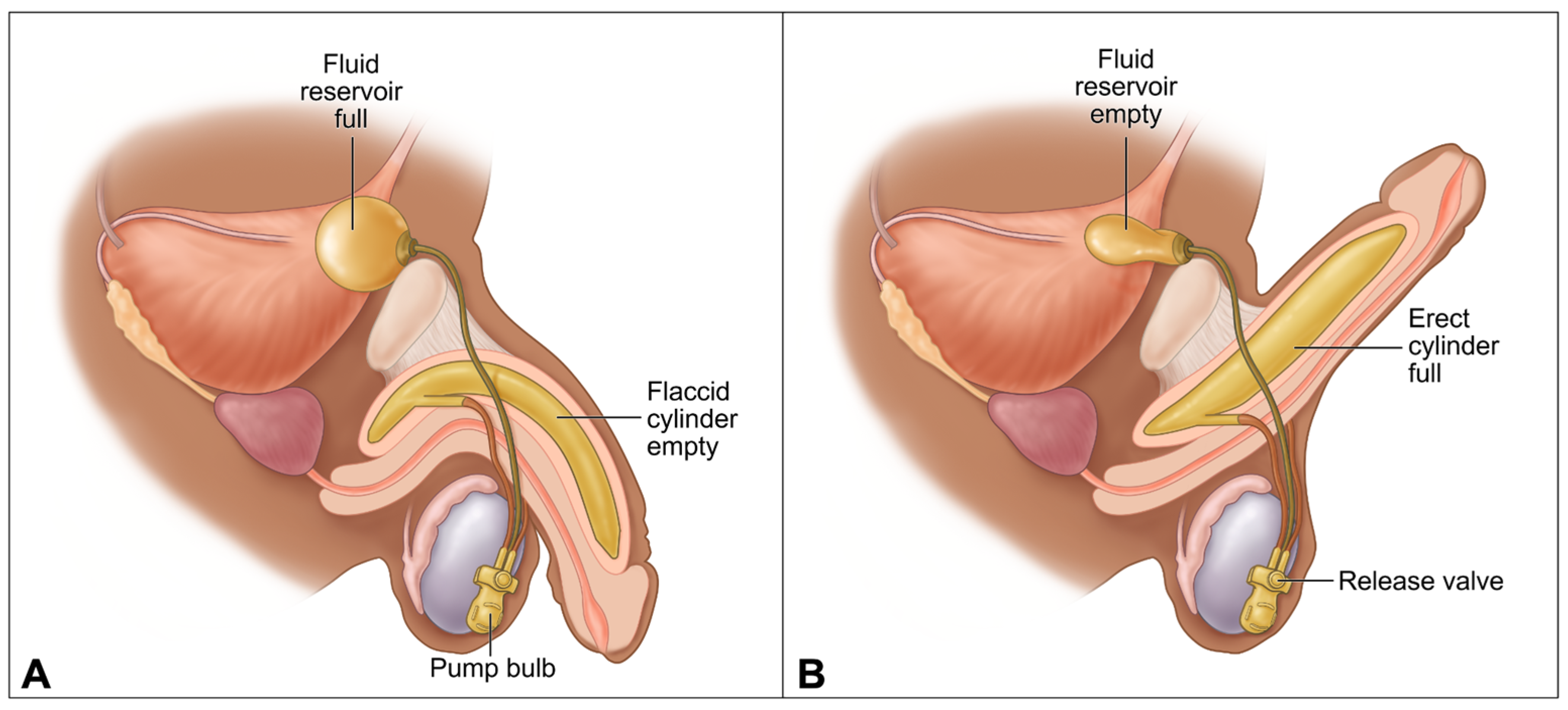 Prosthesis 07 00127 g003 Prosthesis 07 00127 g003