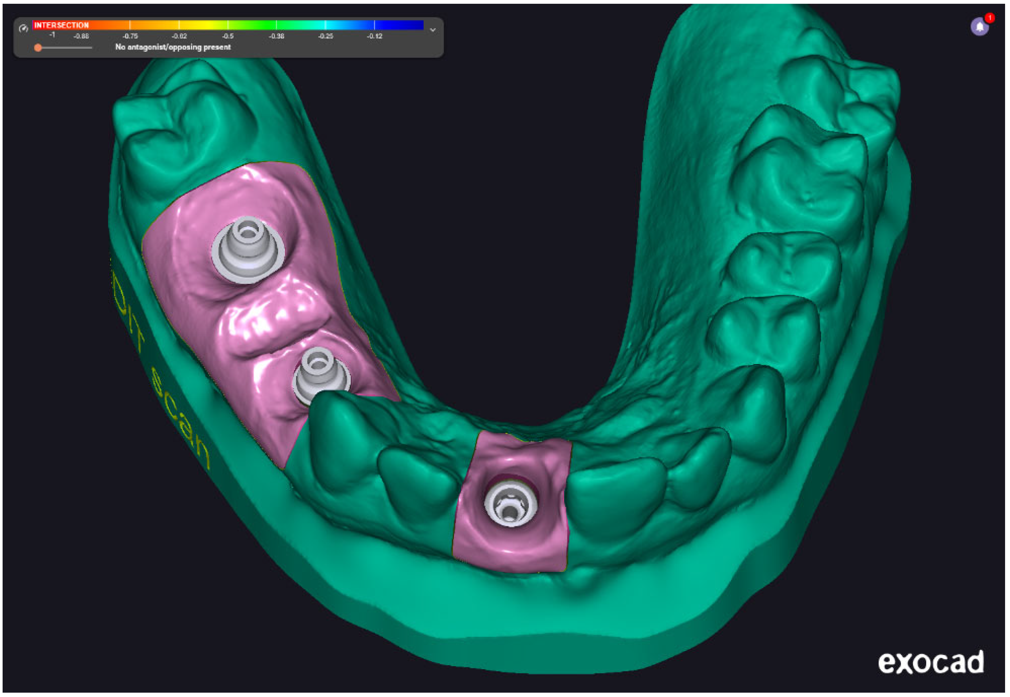Prosthesis 07 00135 g004