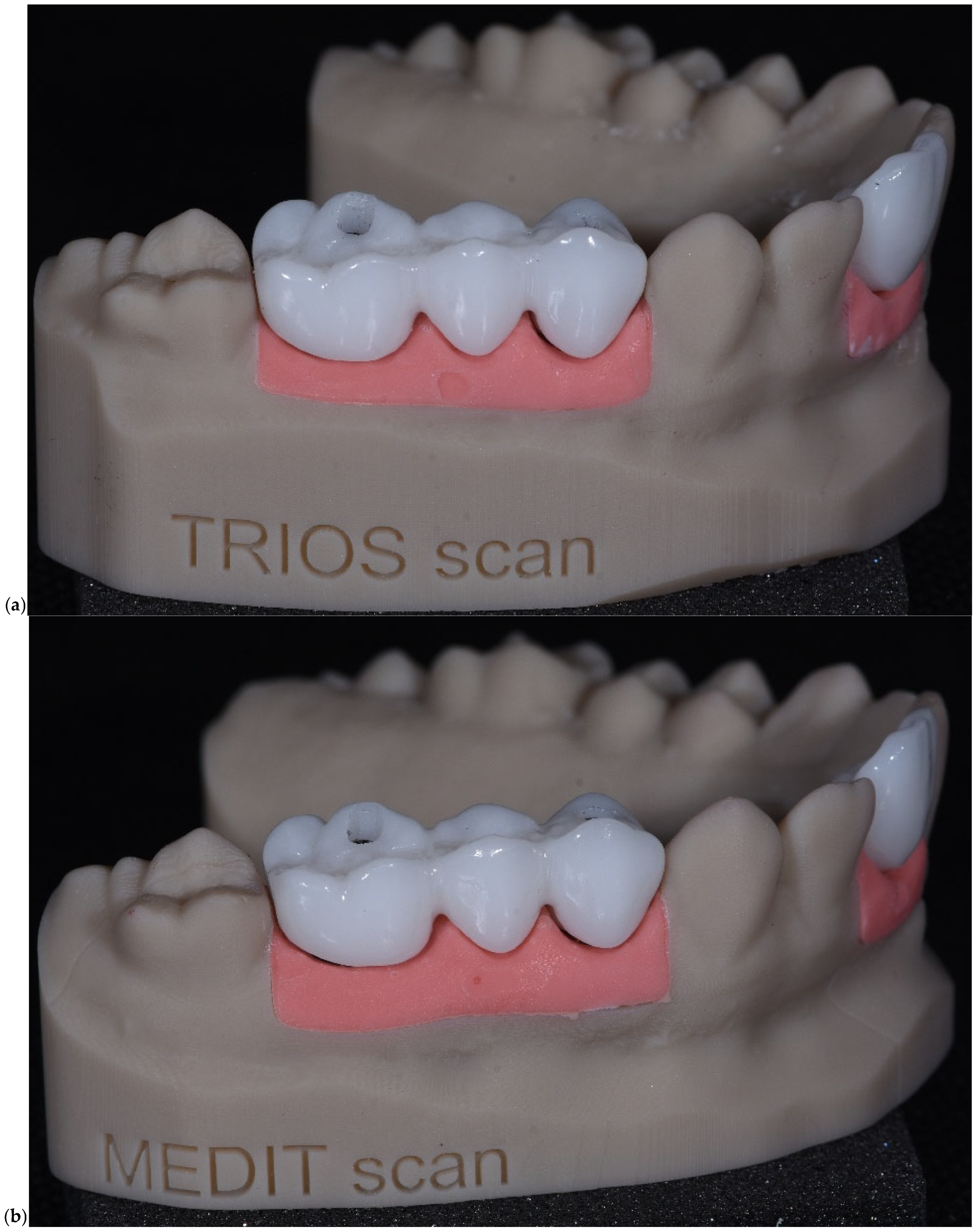 Prosthesis 07 00135 g005