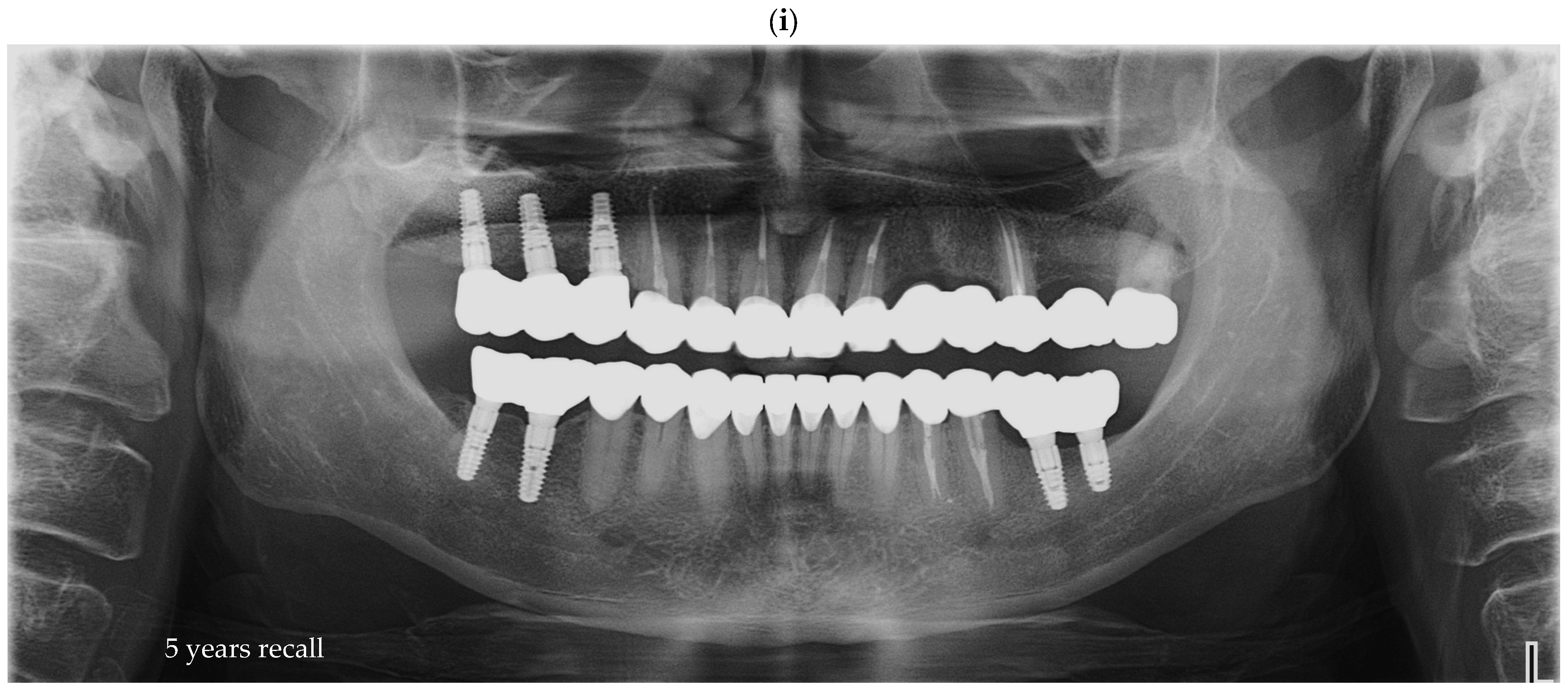 Prosthesis 07 00135 g006b